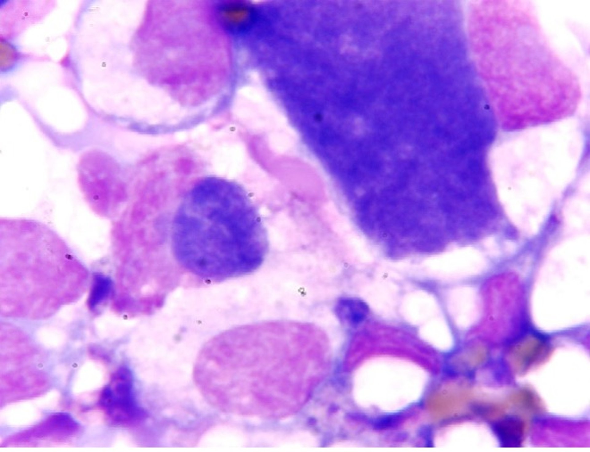 <i >Anaplasma phagocytophilum</i>, intracytoplasmic inclusions
