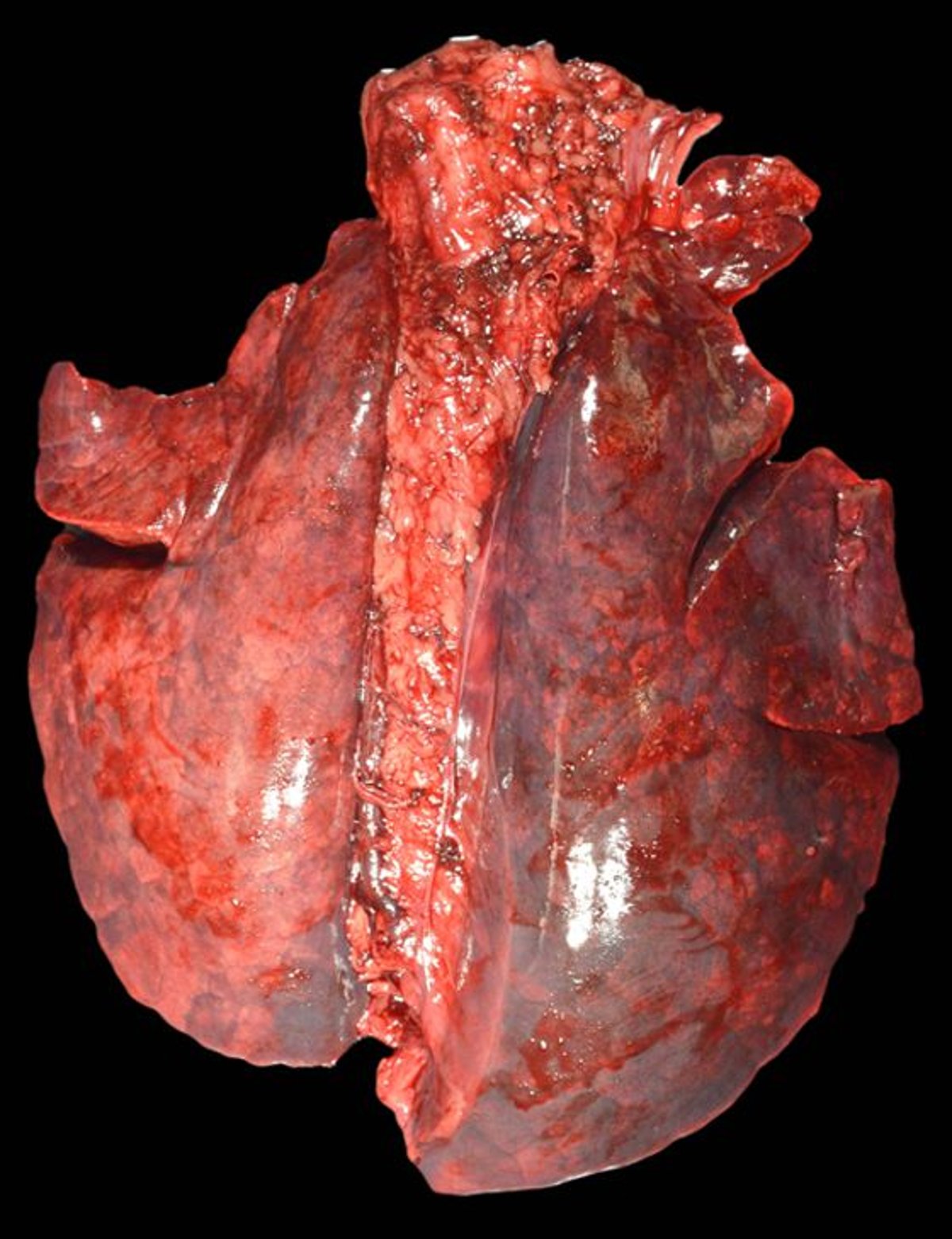 <i >Actinobacillus pleuropneumoniae</i> infection, lung lesions, pig