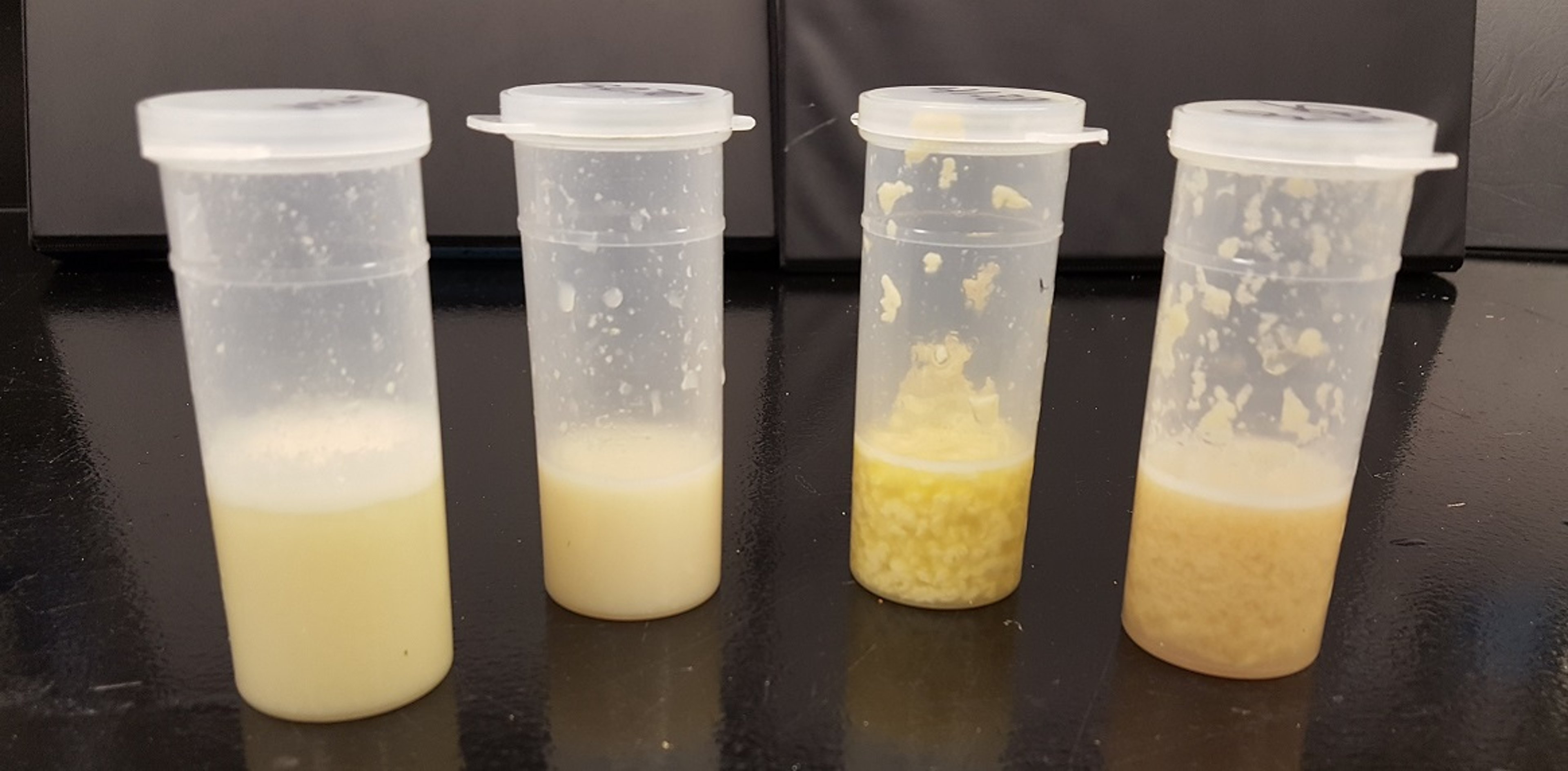 Abnormal milk from cases of mild clinical mastitis