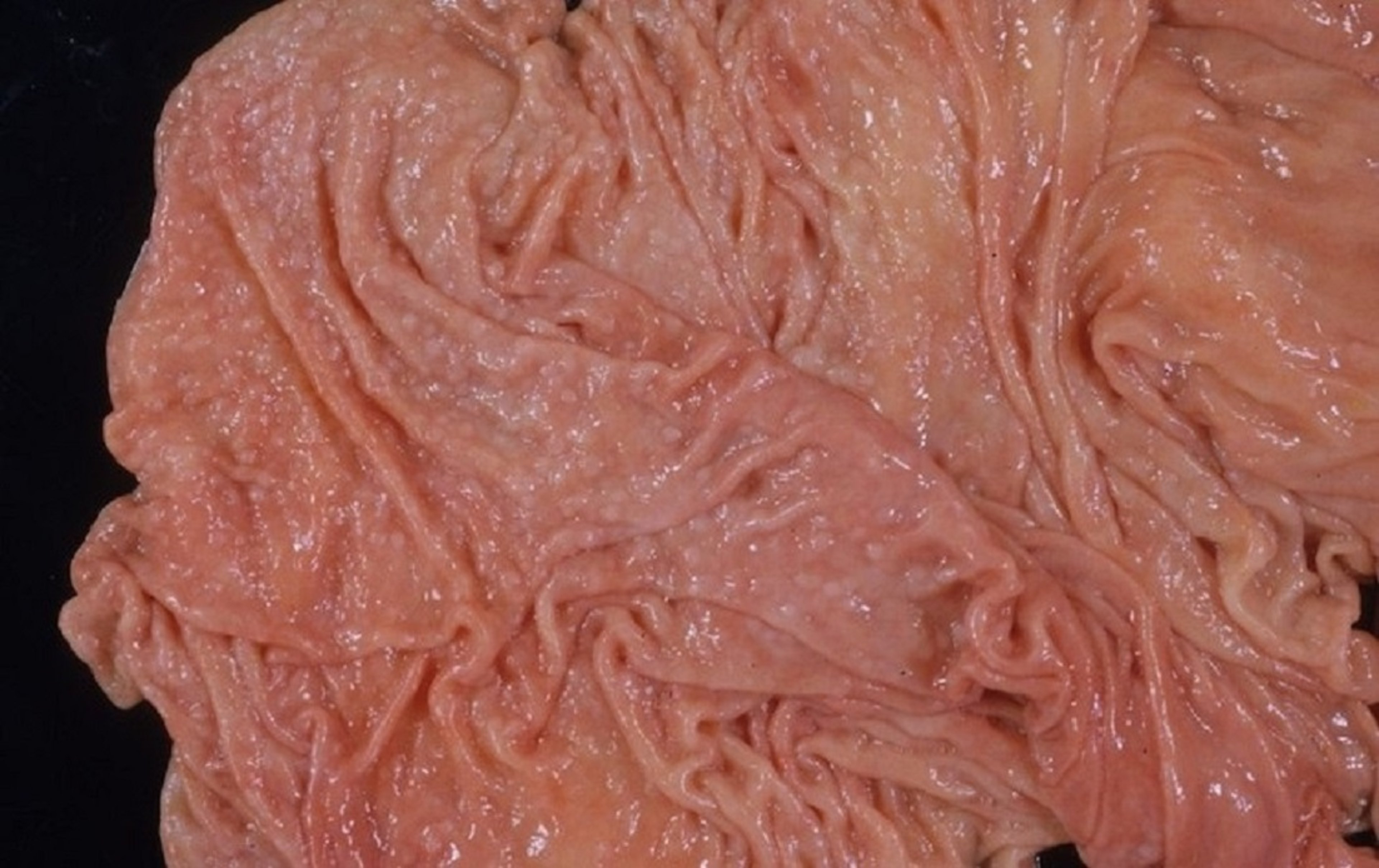 Abomasal lesions due to <i >Ostertagia</i>