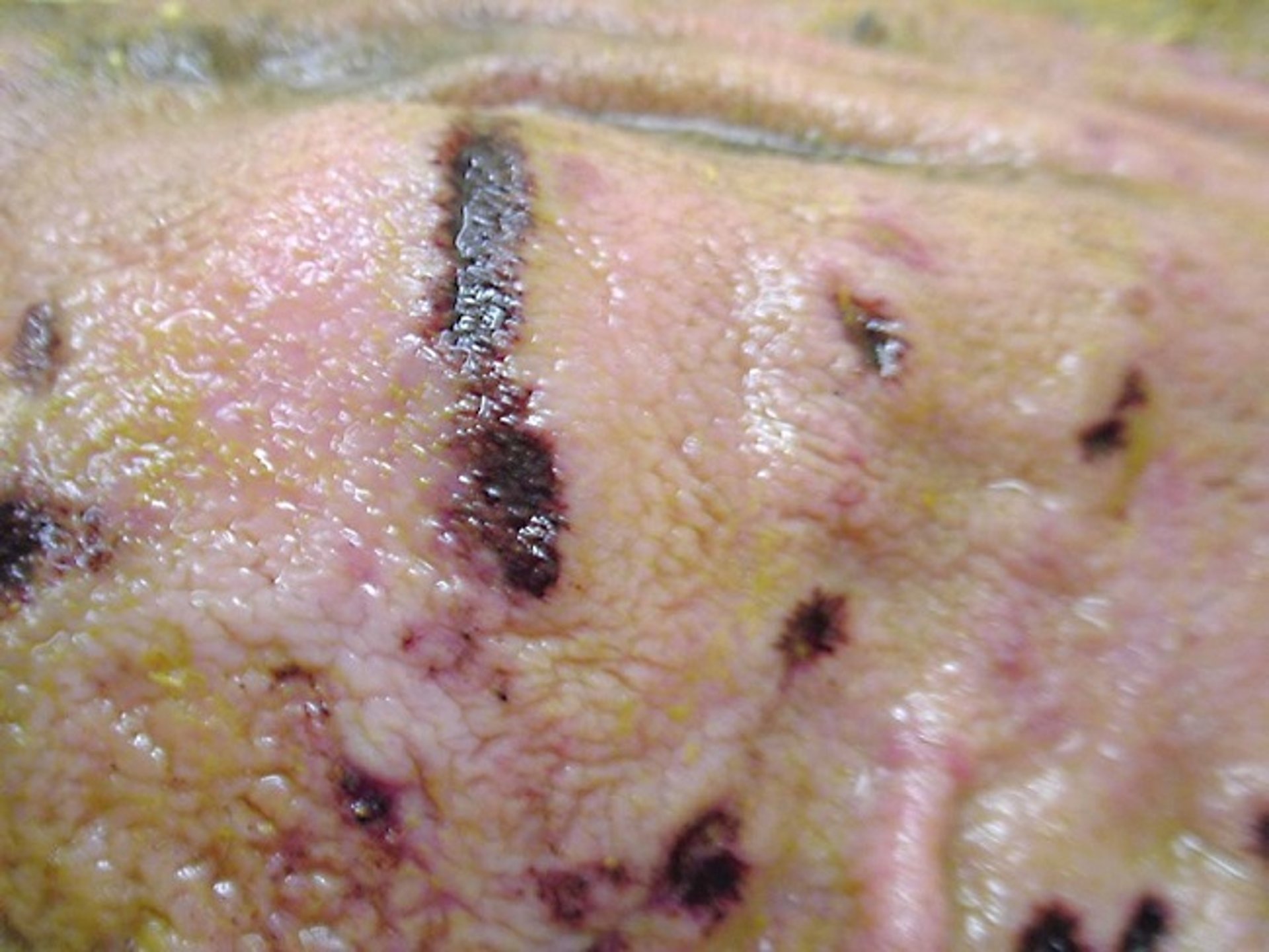 Abomasal ulcer, cow