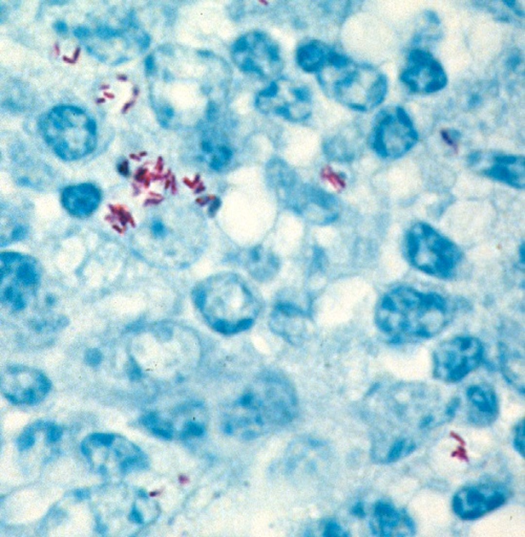 Acid-fast stain of lymph node, Holstein cow