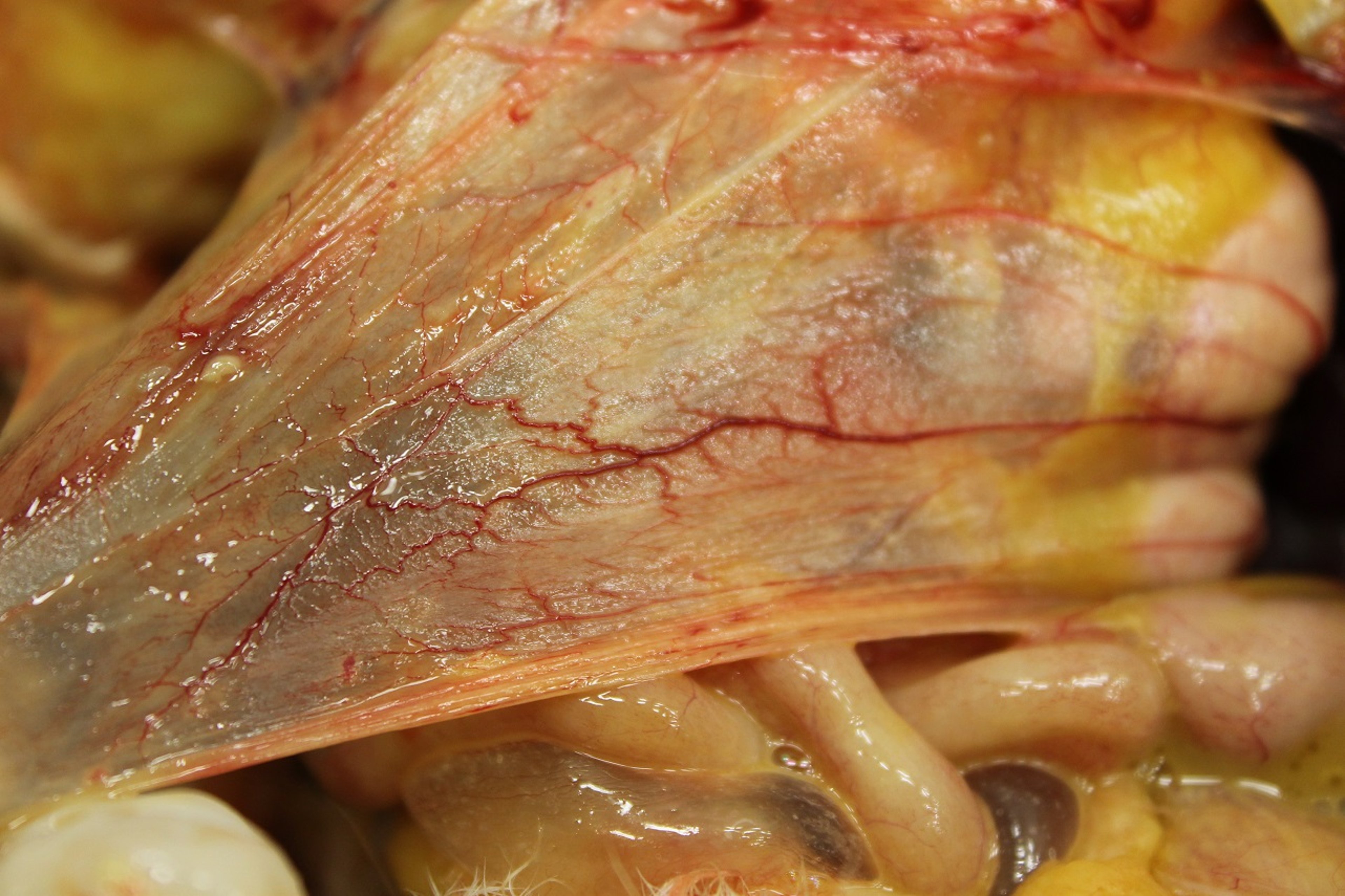 Acute airsacculitis, chicken