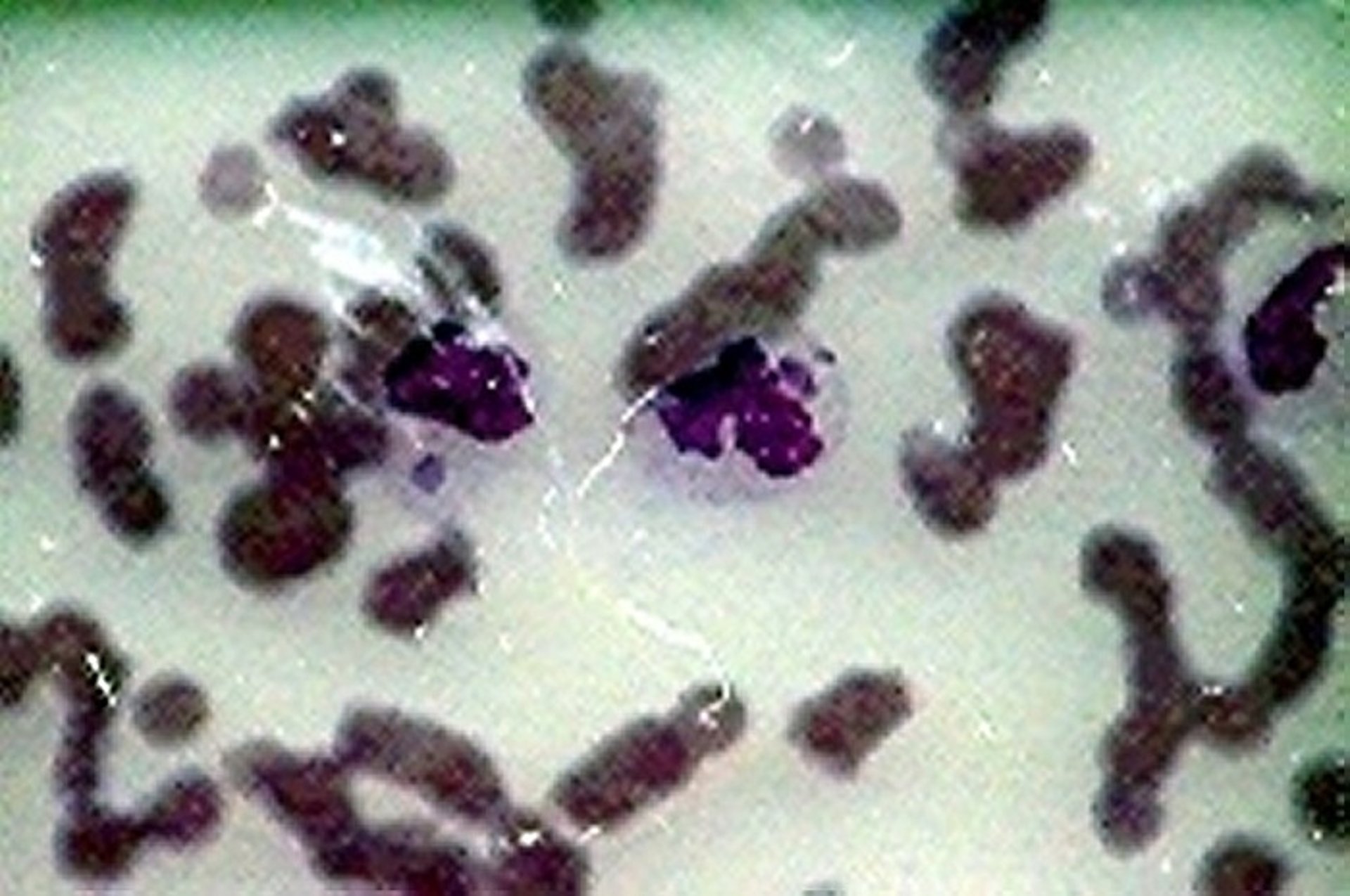 <i >Anaplasma phagocytophilum</i>
