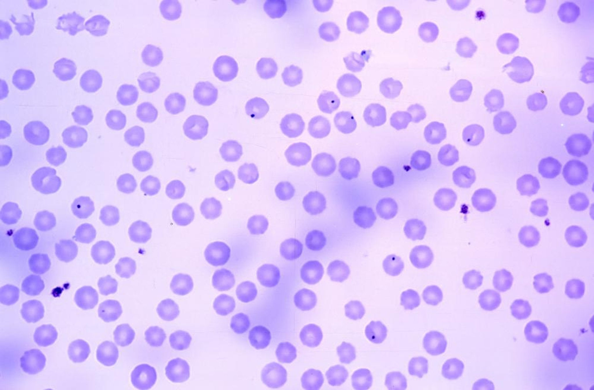 <i >Anaplasma marginale</i>, bovine blood smear