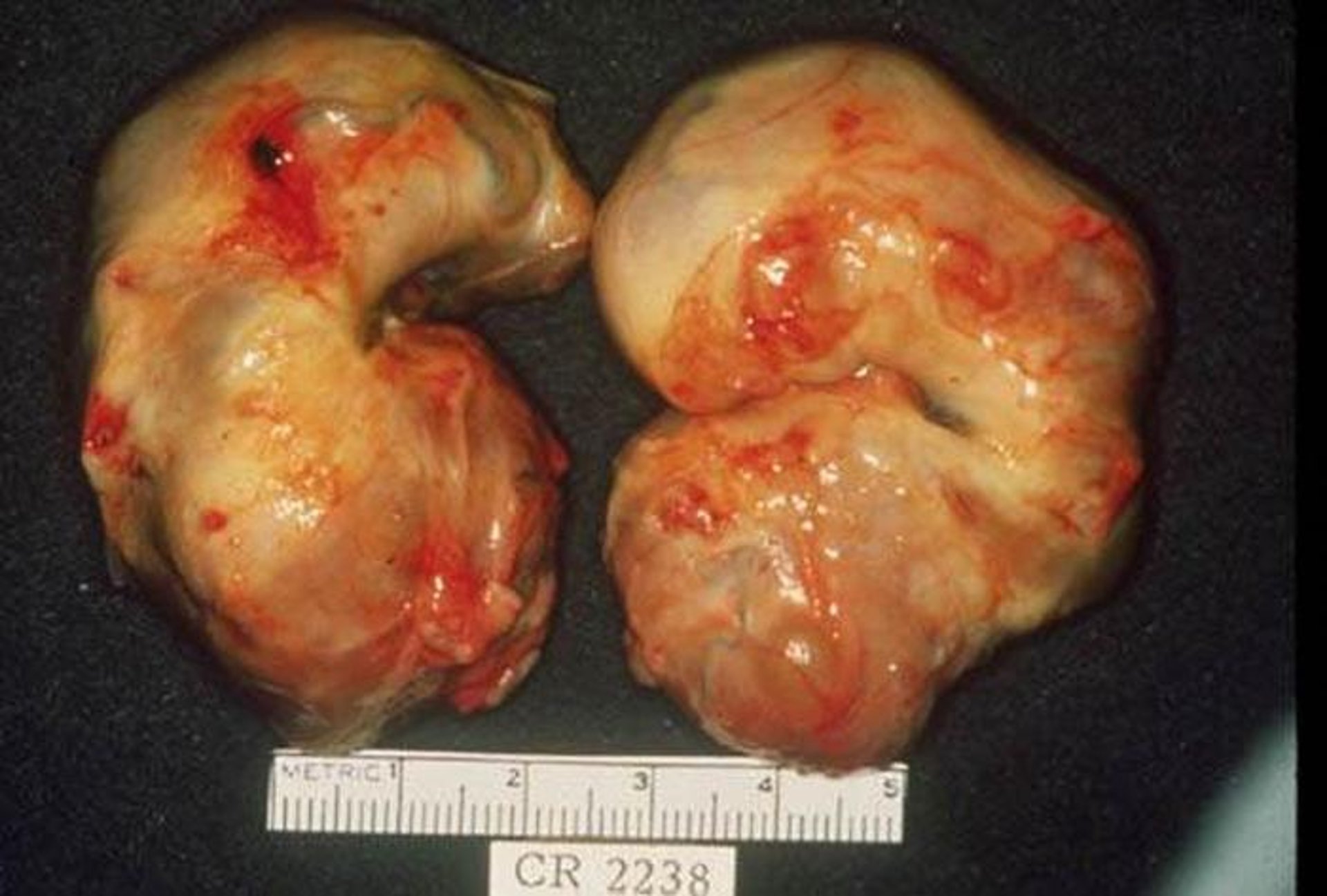 Anestrus ovaries, mare