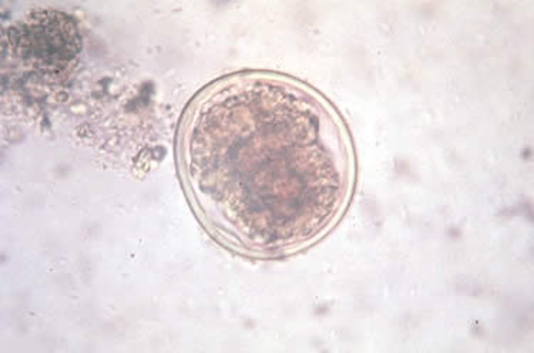 <i >Anisakis</i> spp ovum