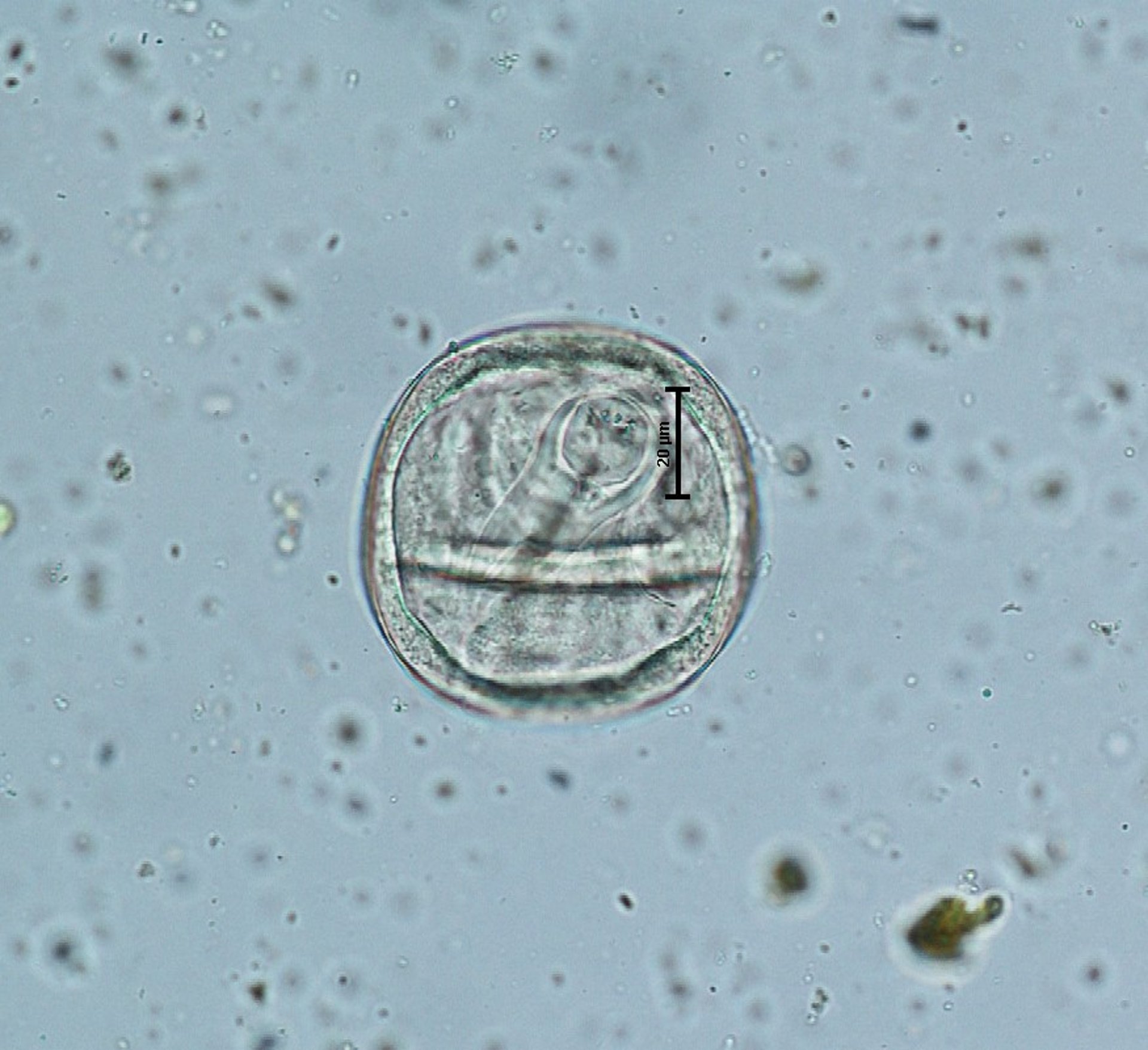<i >Anoplocephala perfoliata</i> egg