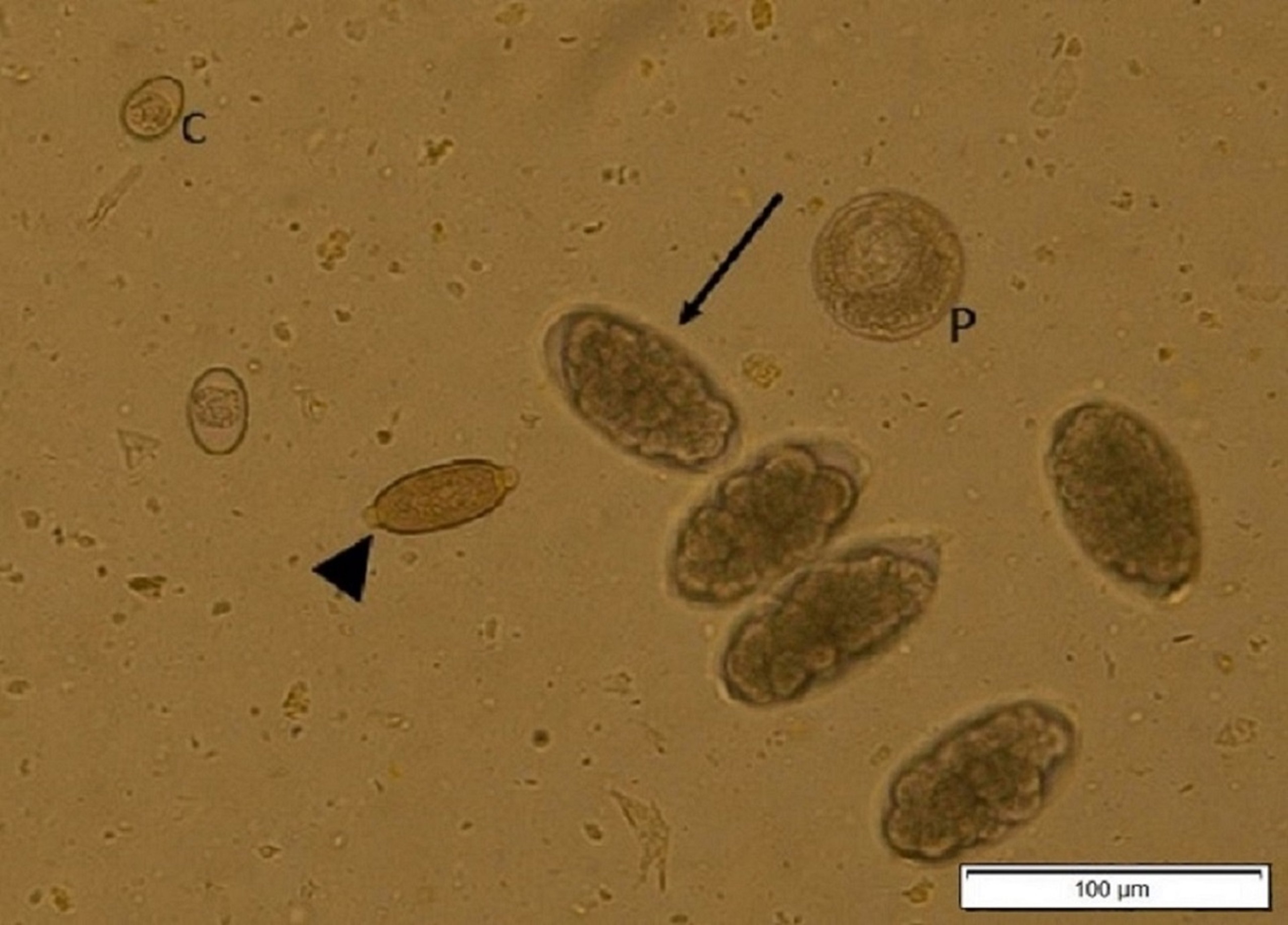 <i >Aonchotheca bovis</i> eggs