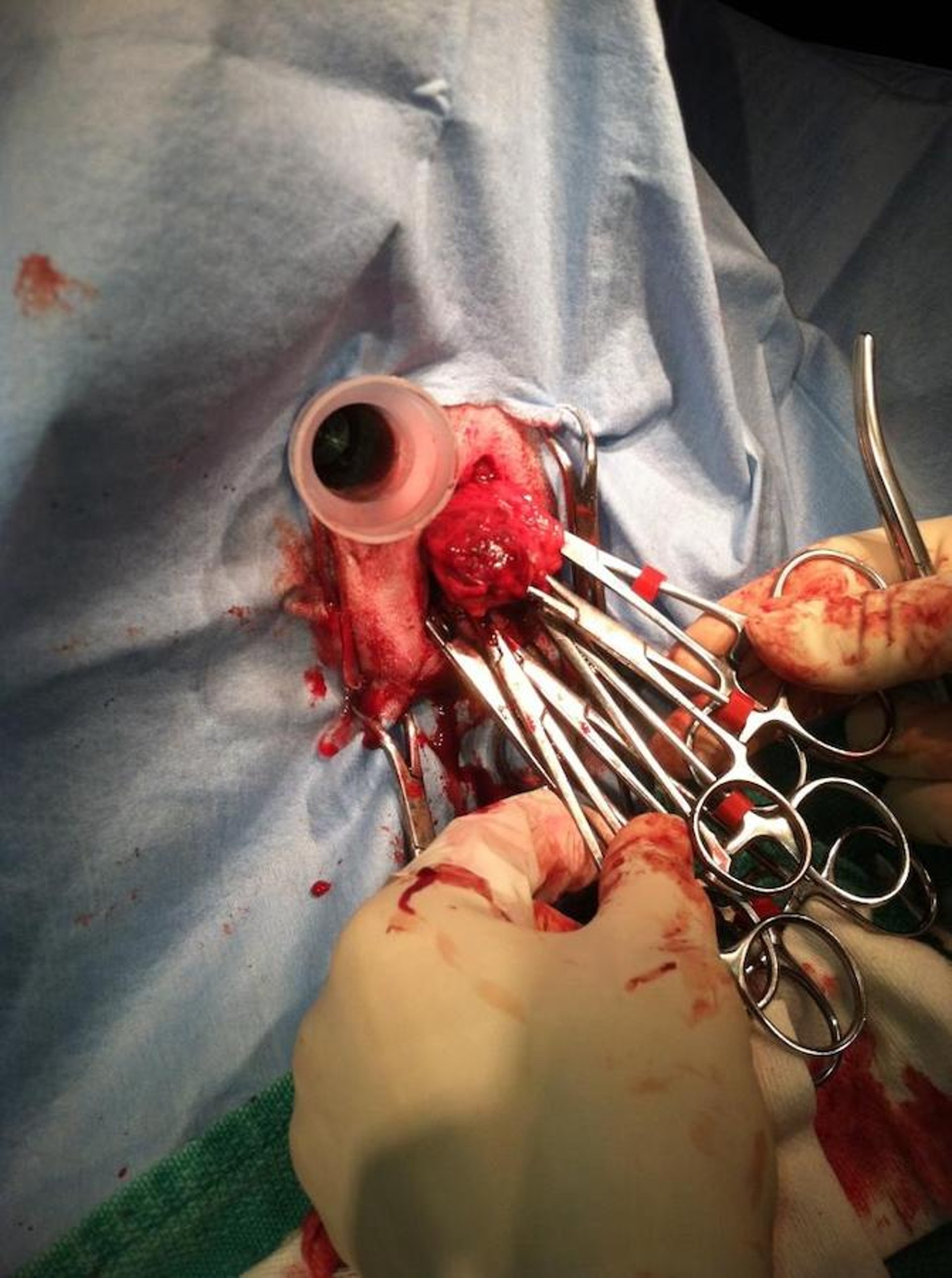 Apocrine gland tumor of anal sac origin