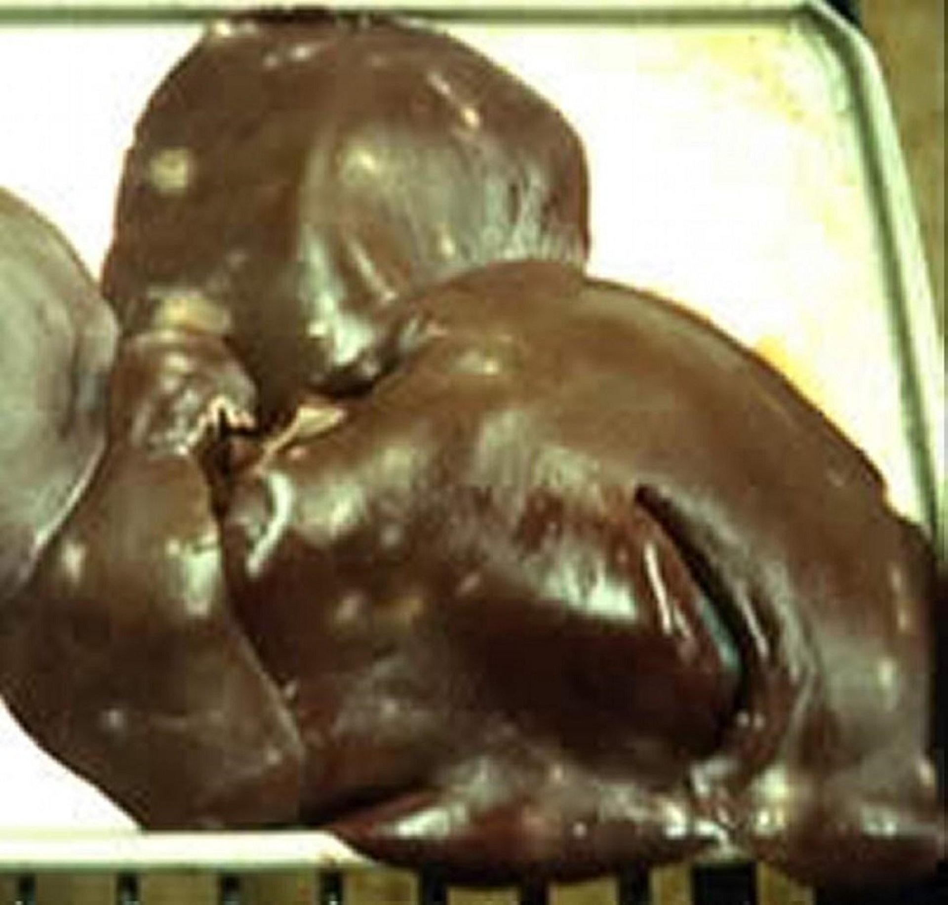 Ascarid larval migration scars, liver, pig