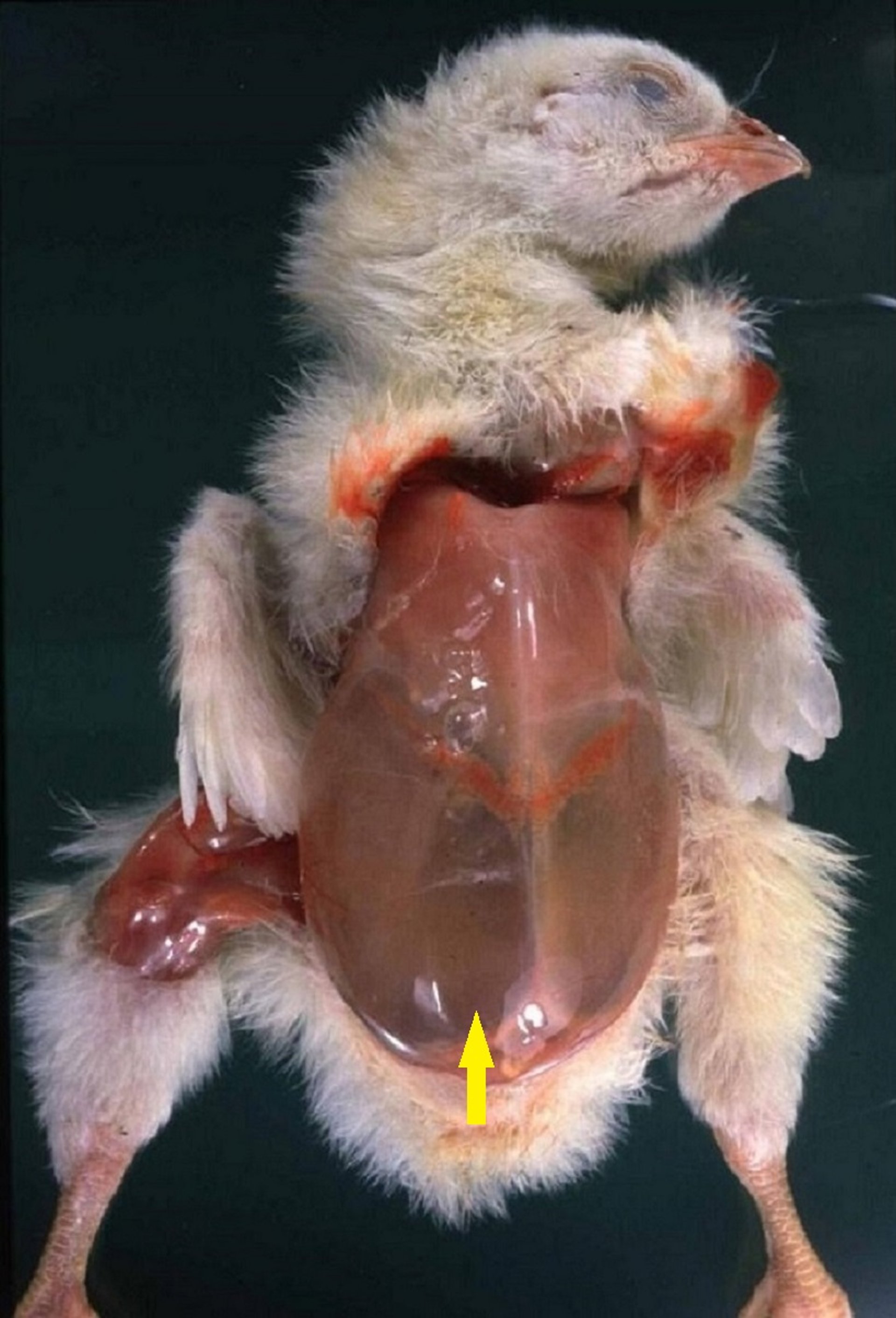 Ascites syndrome, abdominal cavity distention, chick