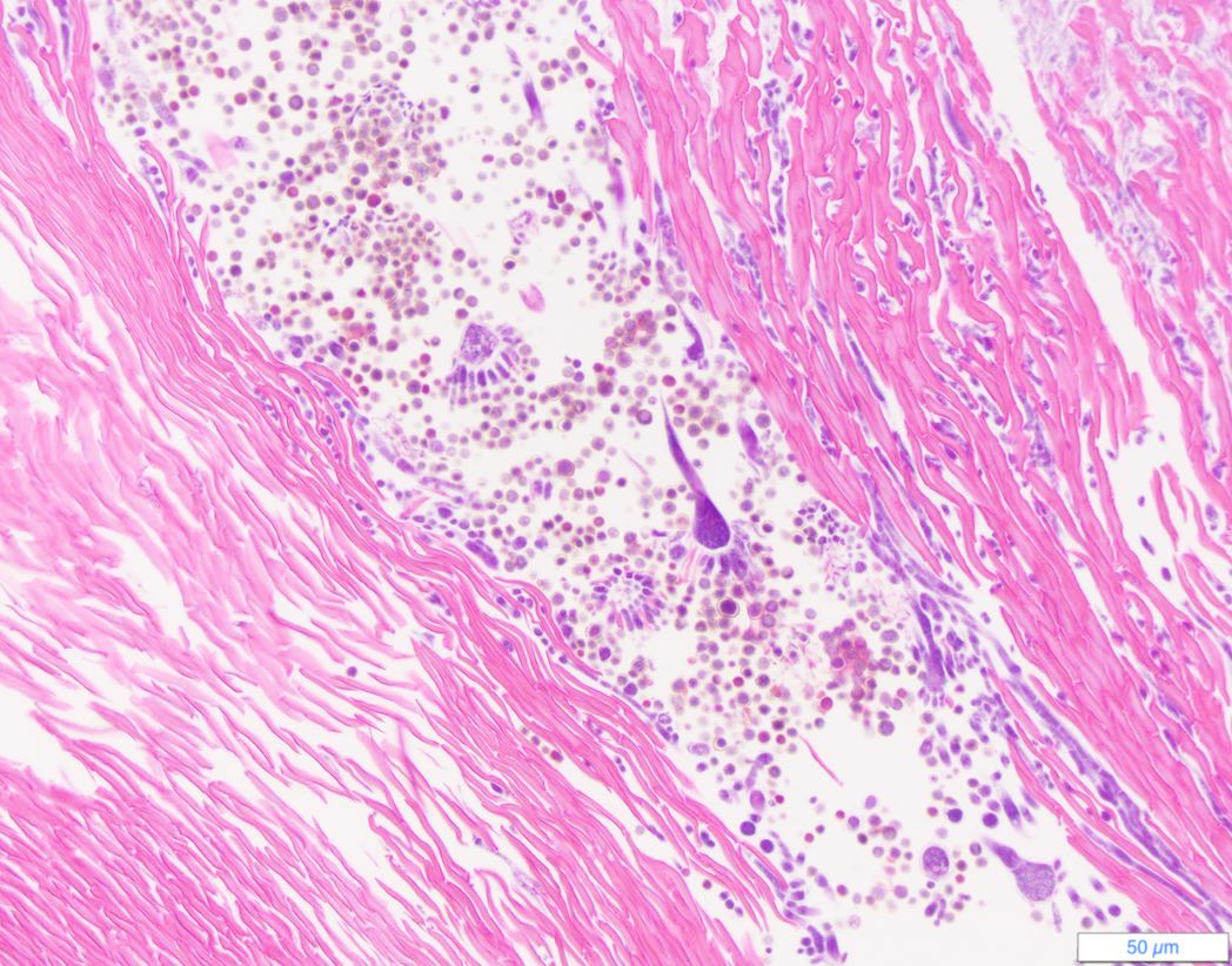 <i >Aspergillus</i> onychomycosis, cat