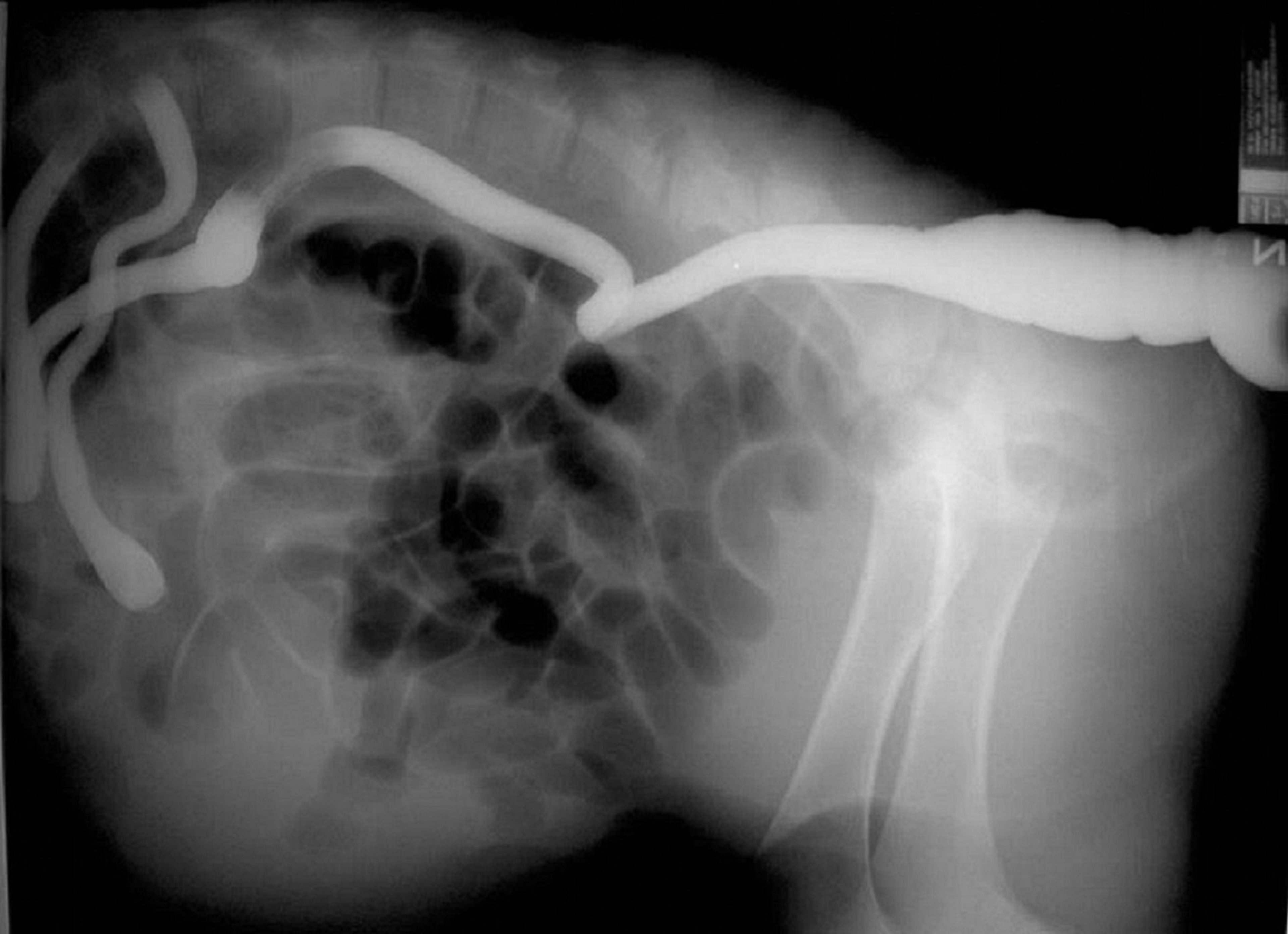Atresia coli, calf, radiograph