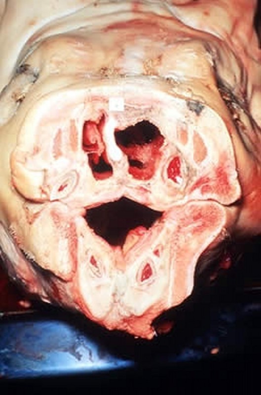 Image:Atrophic rhinitis, pig-Merck Veterinary Manual