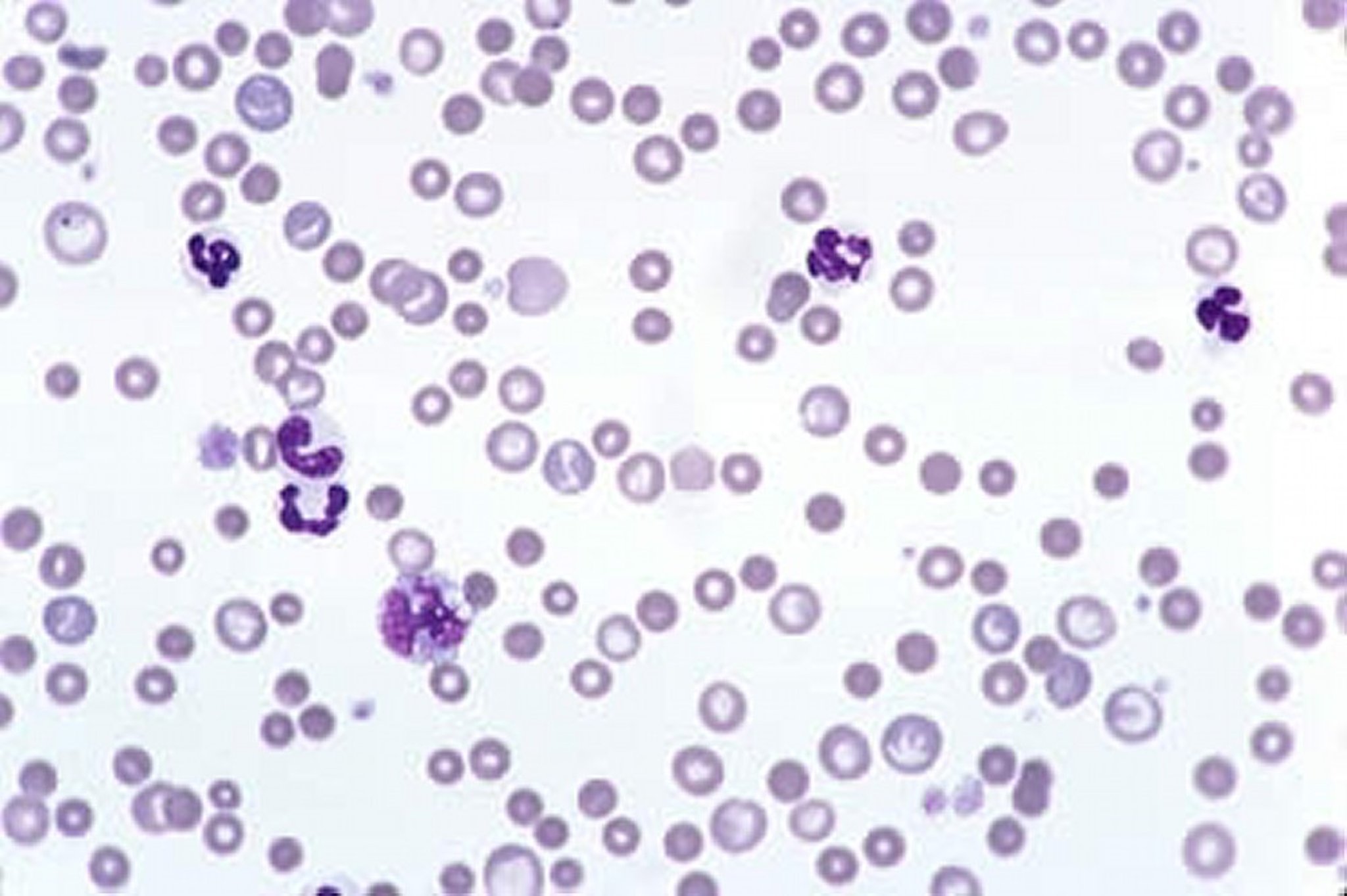 Autoimmune hemolytic anemia, blood smear (50X), dog
