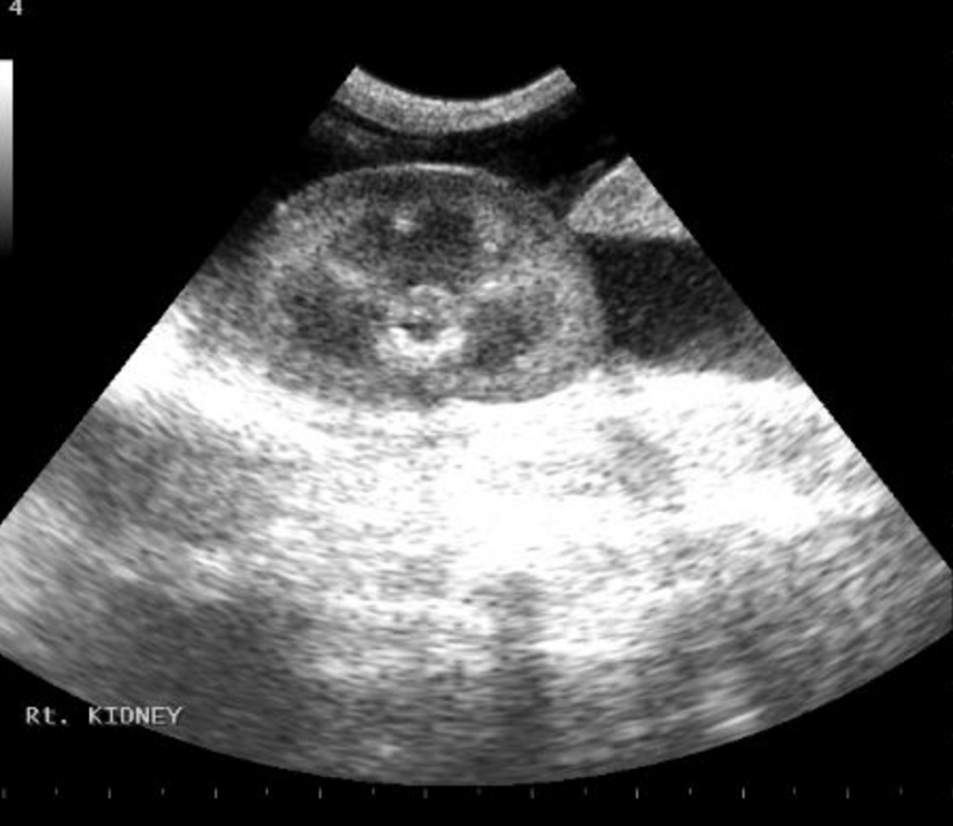 Ecografia abdominal no local de atendimento