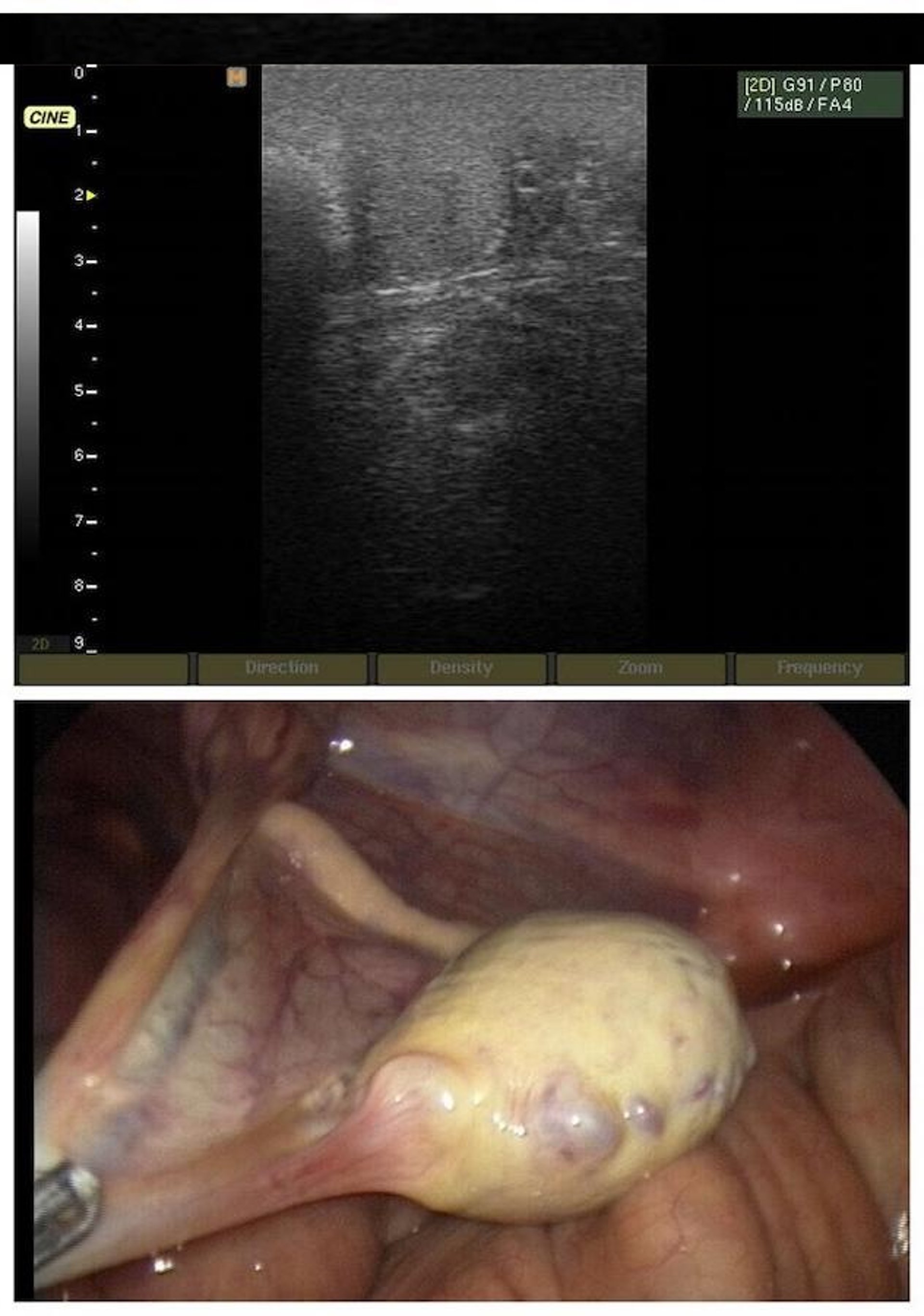 Abdominal testis, stallion