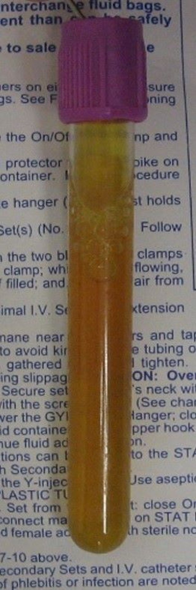 Abdominocentesis sample, horse