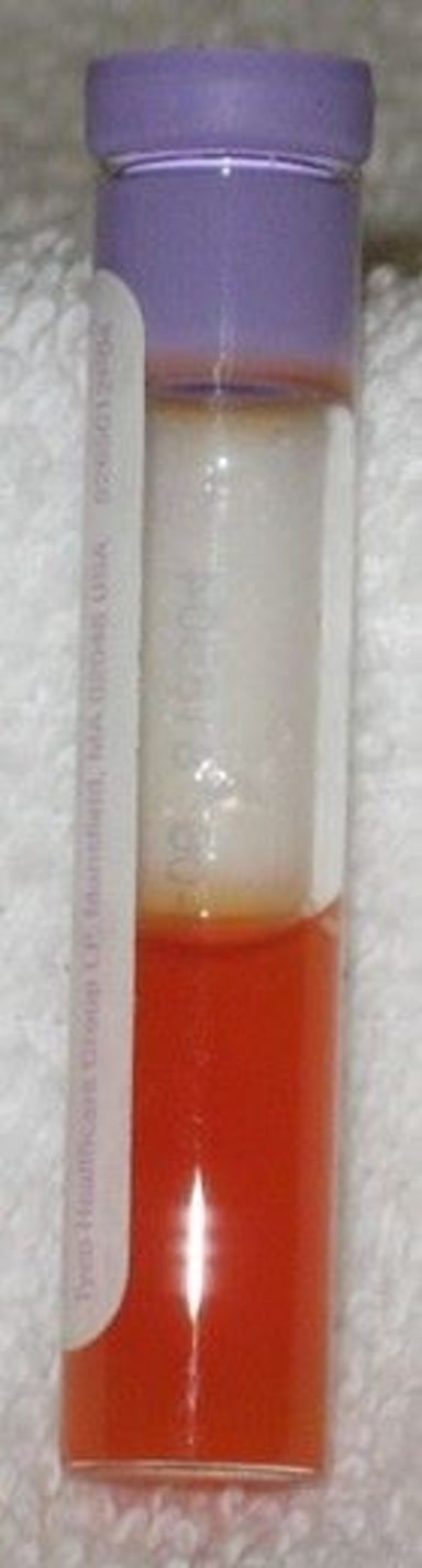 Abdominocentesis, serosanguinous sample, horse