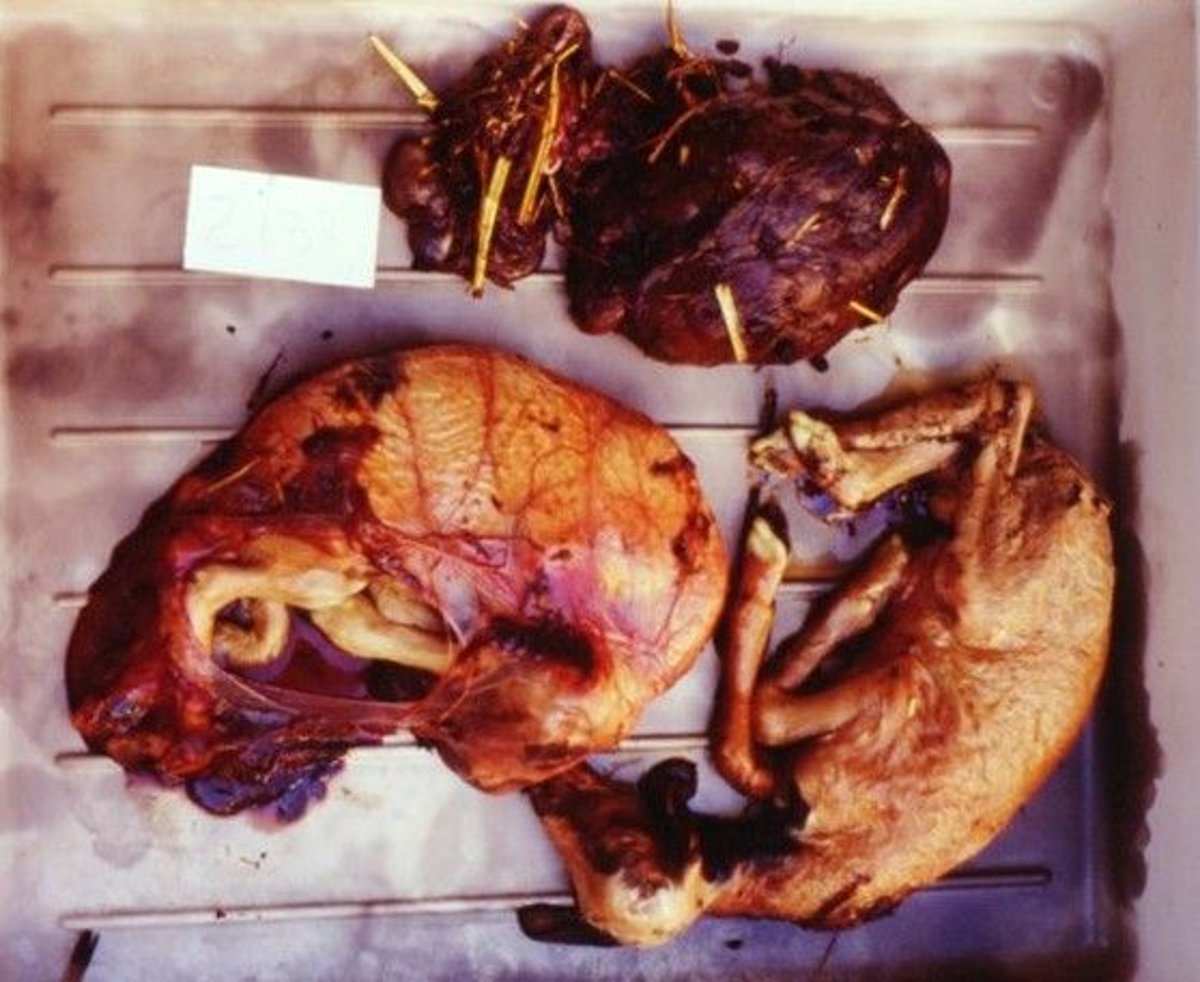 Abortion due to <i >Toxoplasma gondii</i>, sheep