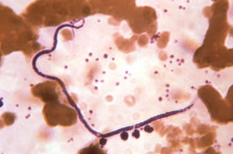 Microfilárias de <i >Acanthocheilonema</i>