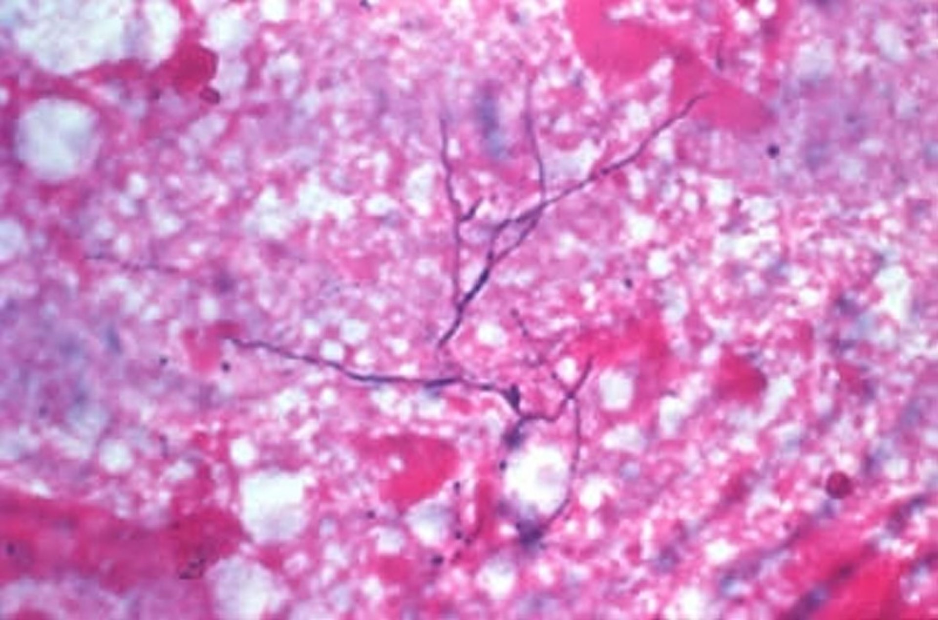 <i >Actinomyces bovis</i>, frotis teñido con tinción de Gram
