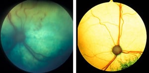 Coriorretinitis activa y fondo normal, gato