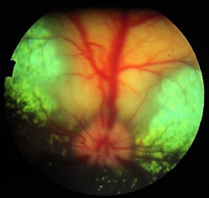 Coriorretinitis activa secundaria a blastomicosis sistémica, perro