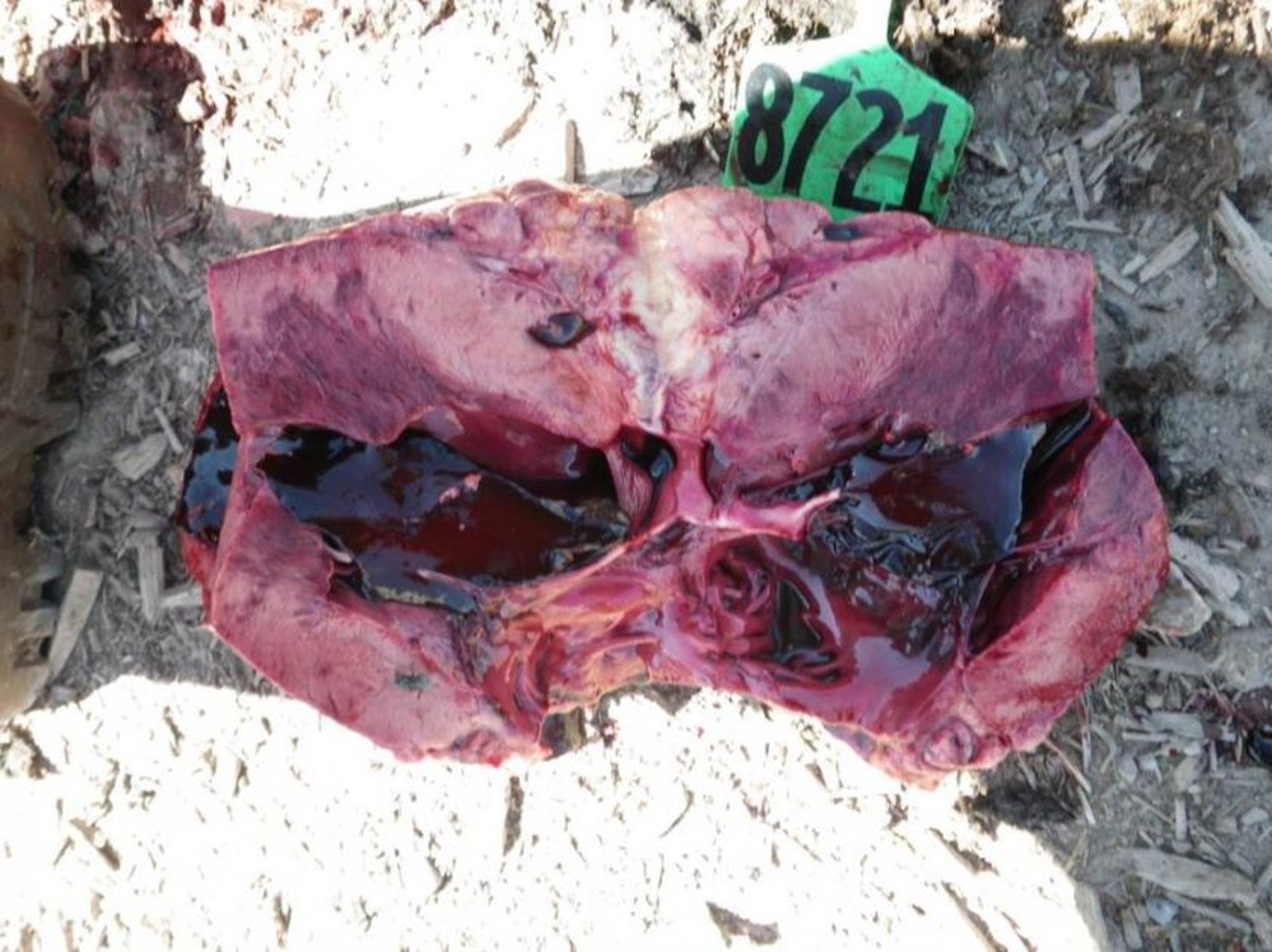 Panmiocarditis aguda
