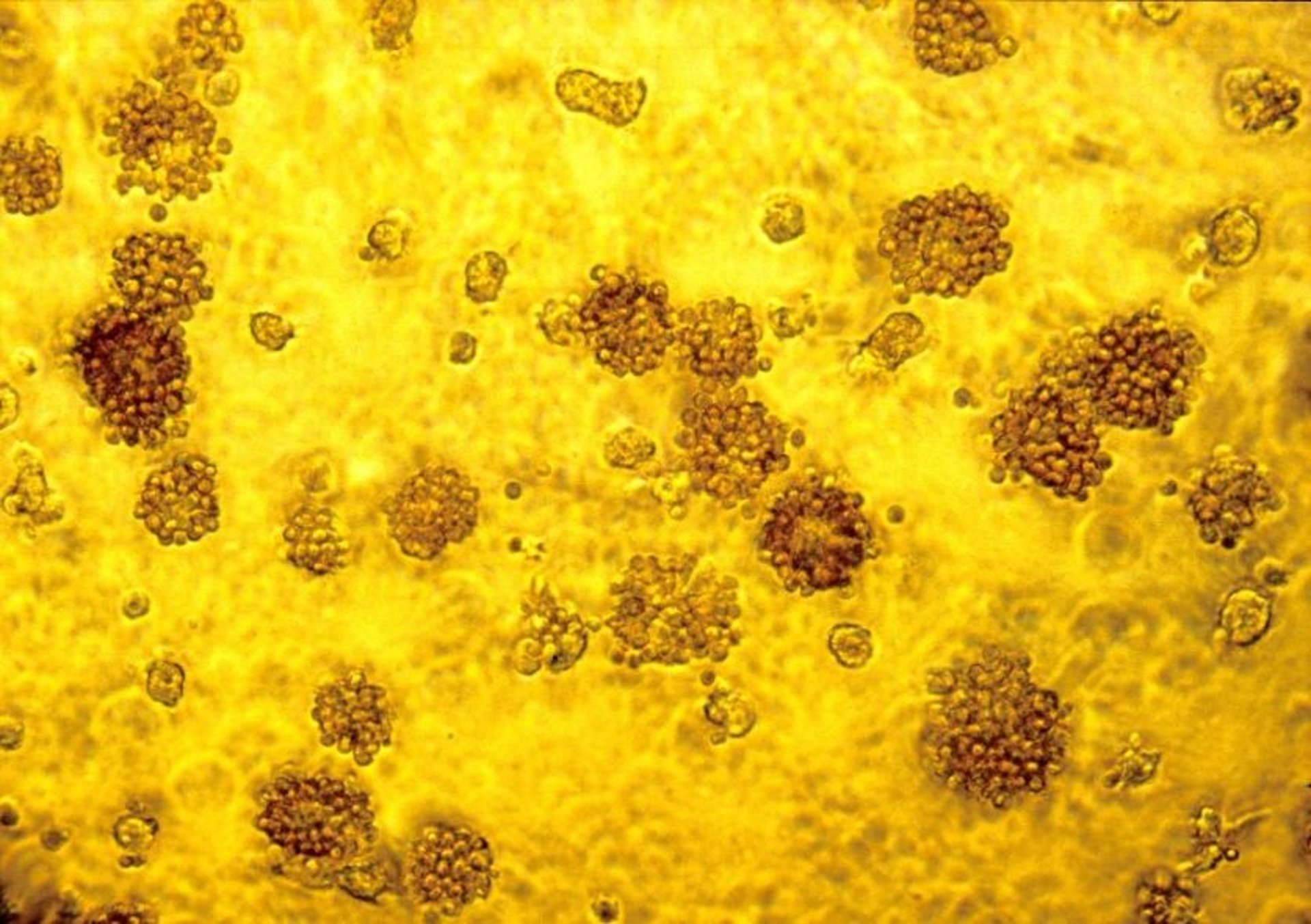 Virus de la peste porcina africana, hematoabsorción