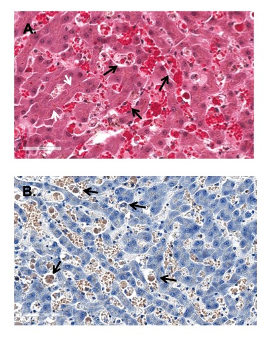 Agglutinating IMHA, photomicrograph, dog