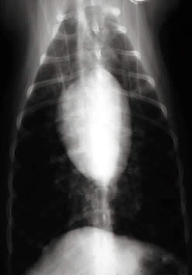 Bronquiolitis alérgica, radiografía (ventrodorsal)