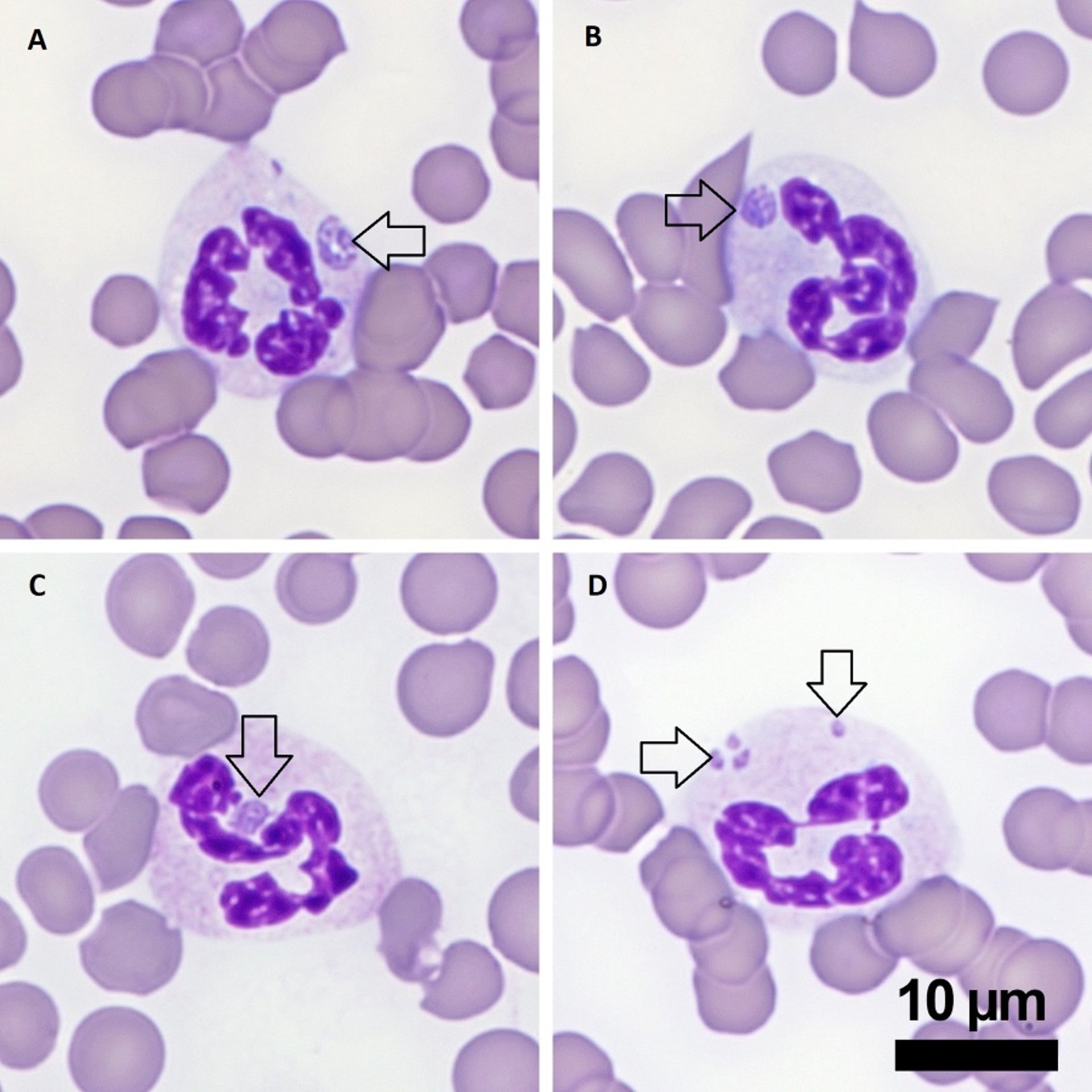 <i >Anaplasma phagocytophilum</i>, cytological image, horse