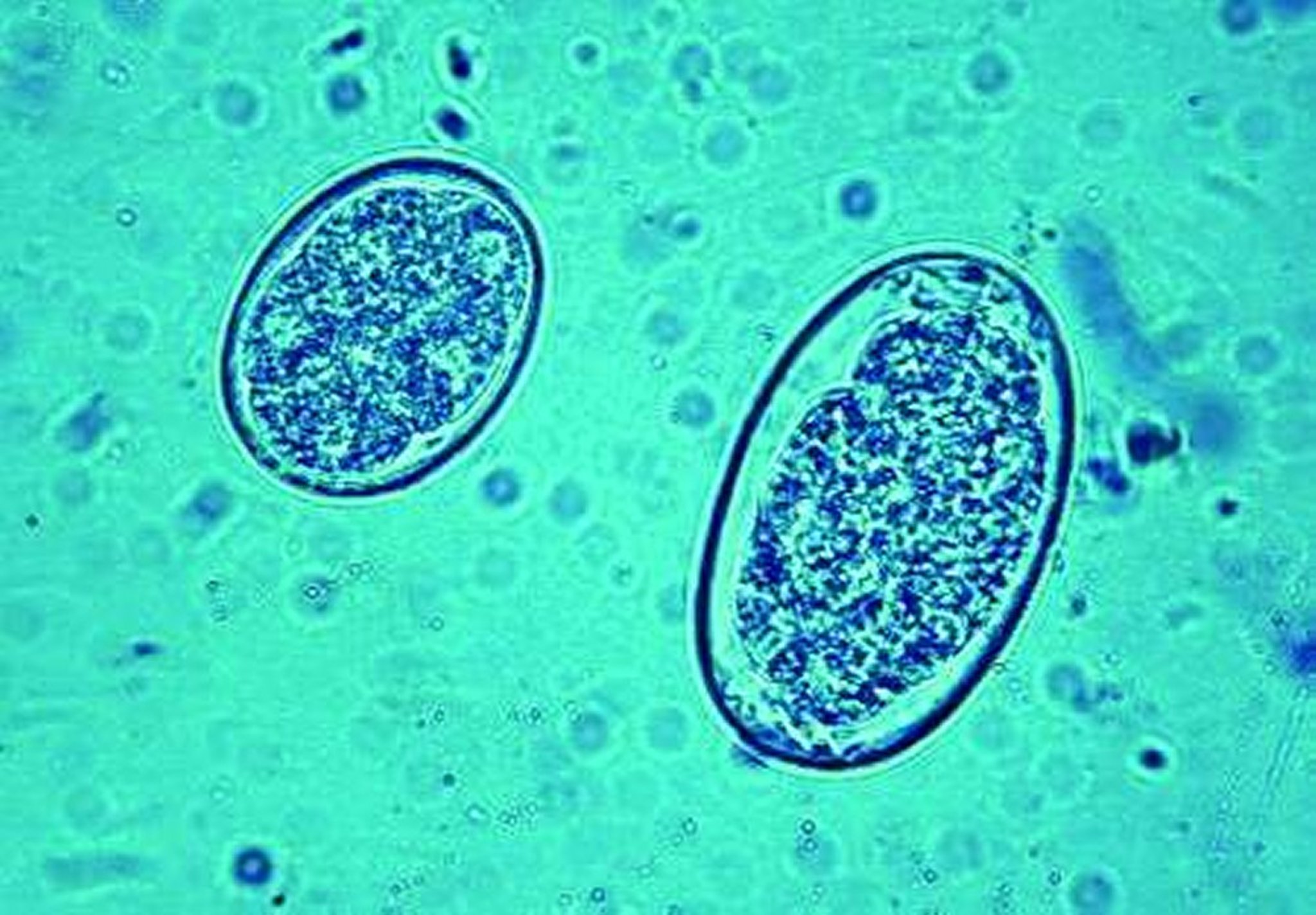 Huevos, <i >Ancilostoma</i> y <i >Uncinaria</i>, perro
