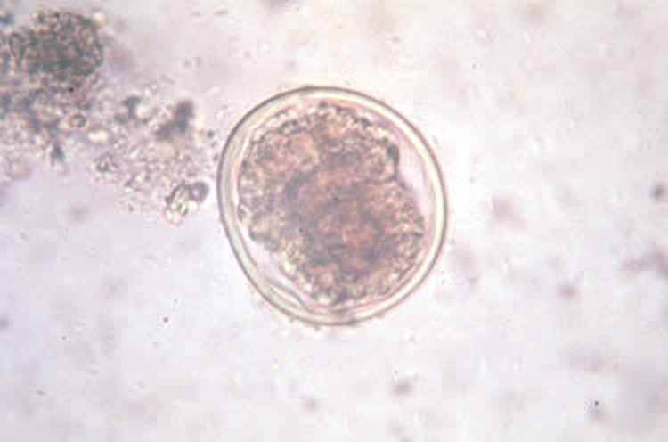 <i >Anisakis</i> spp, huevo embrionado