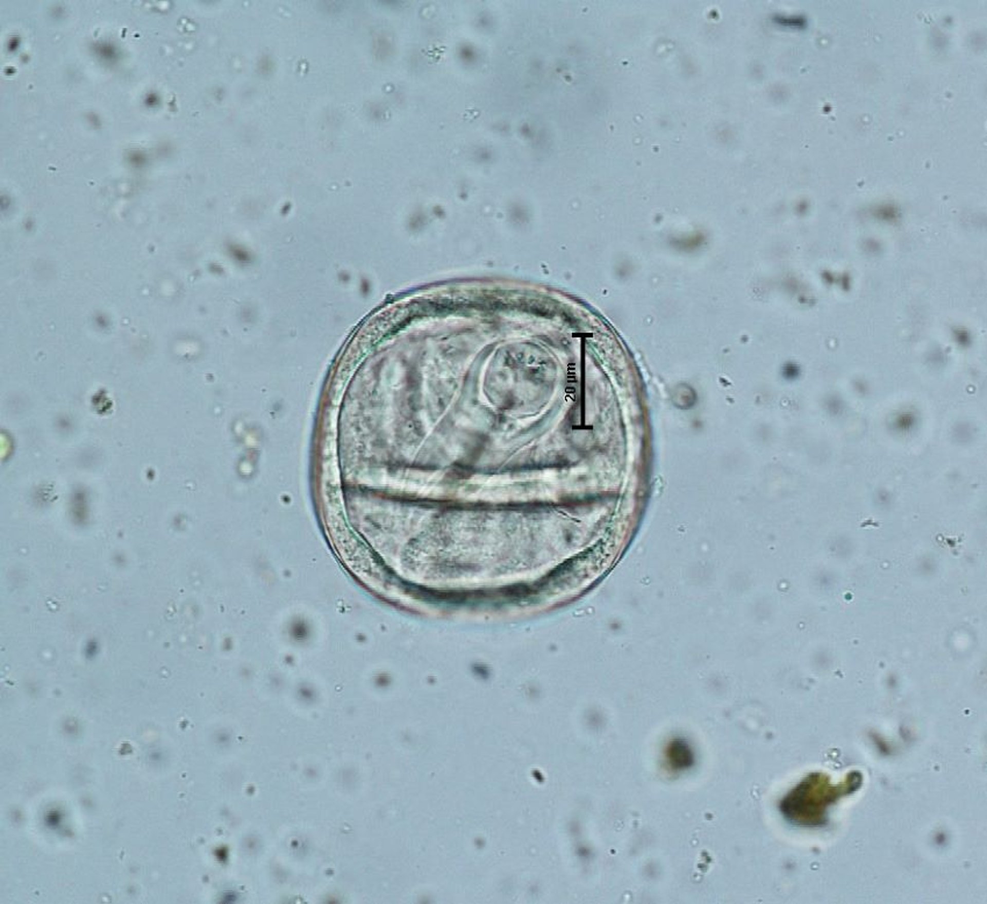 <i >Anoplocephala perfoliata</i>, egg