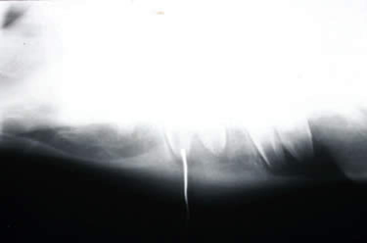 Osteítis apical, radiografía, caballo