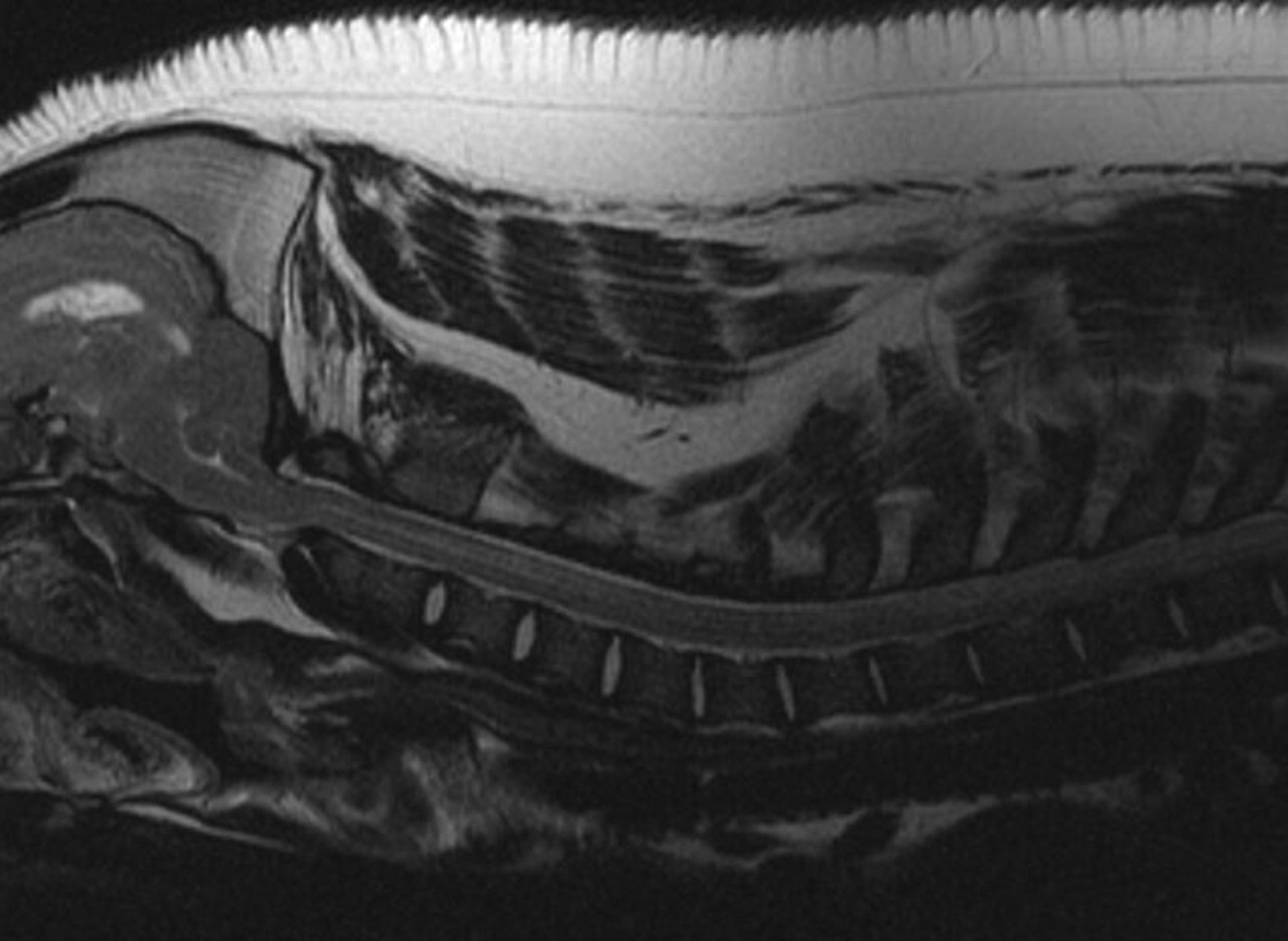 Arnold-Chiari malformation, pig, MRI