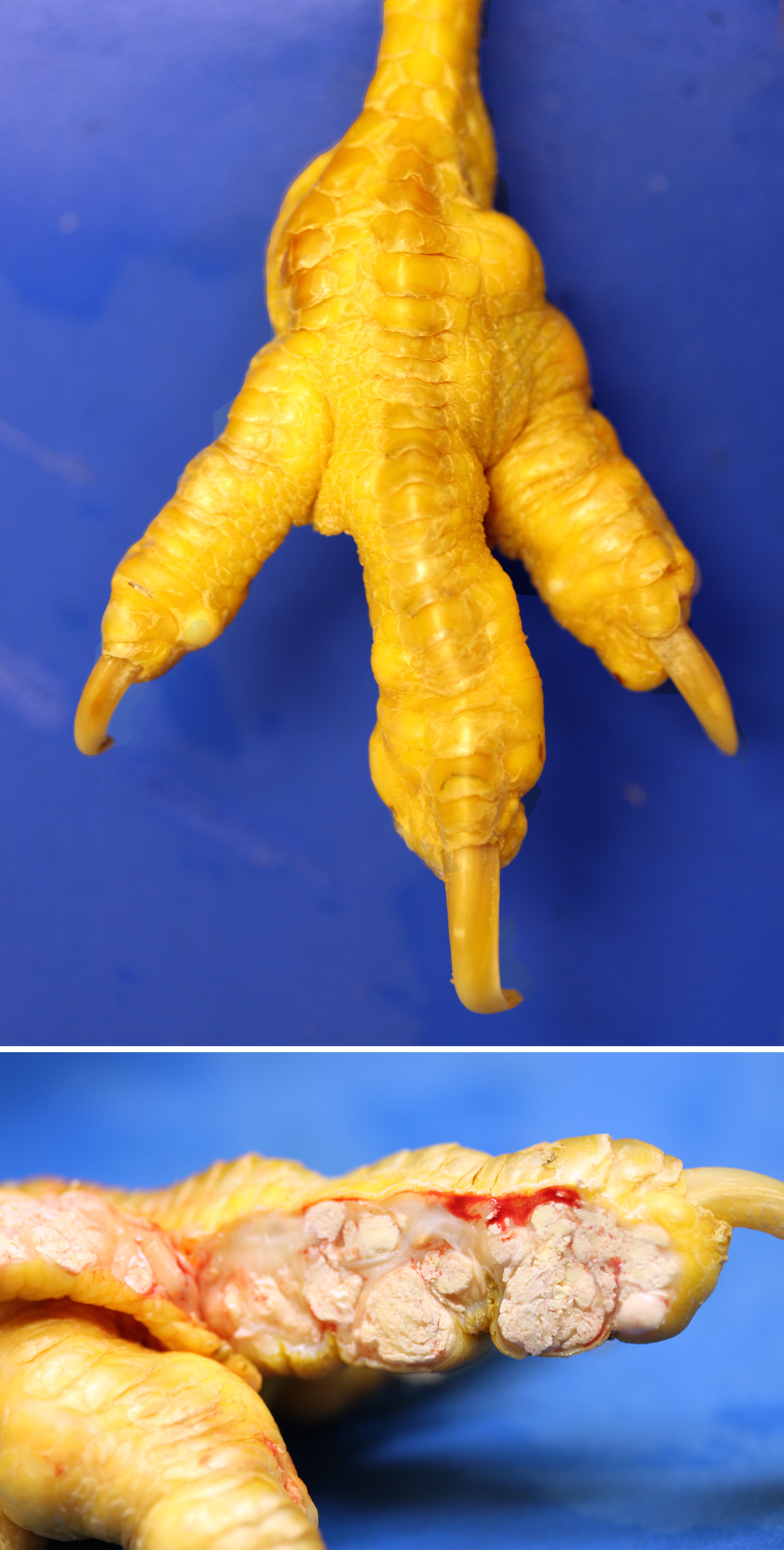 Deposición articular de urato