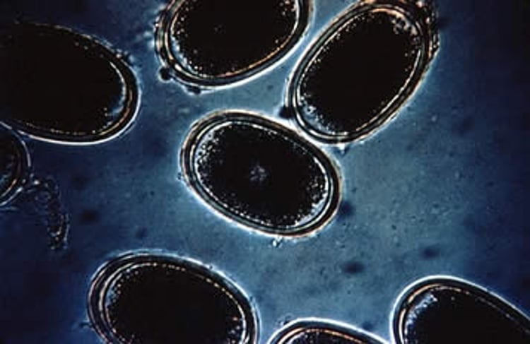 <i >Ascaridia galli</i>, eggs, poultry