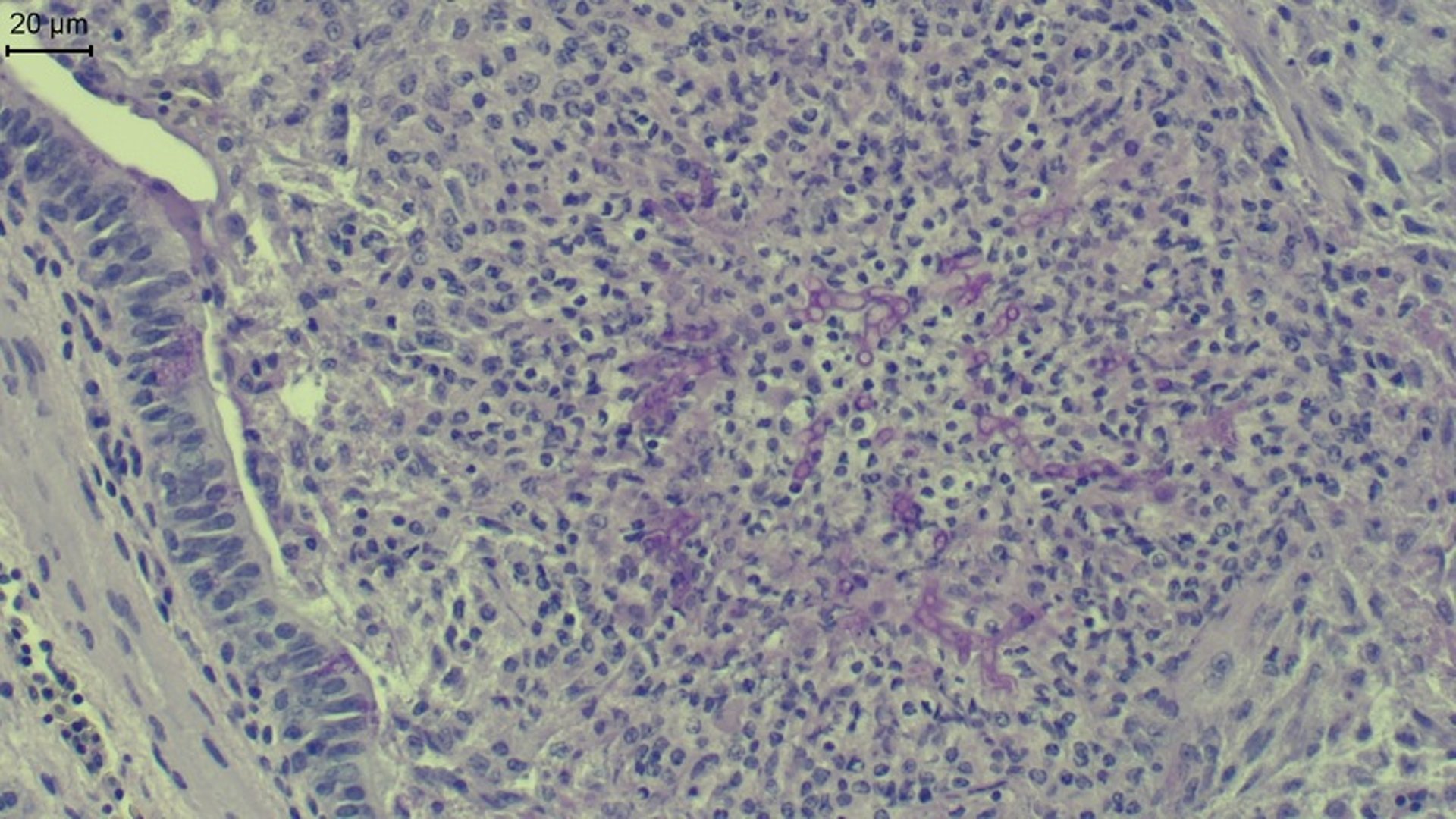 <i >Aspergillus</i>, pulmão, frango