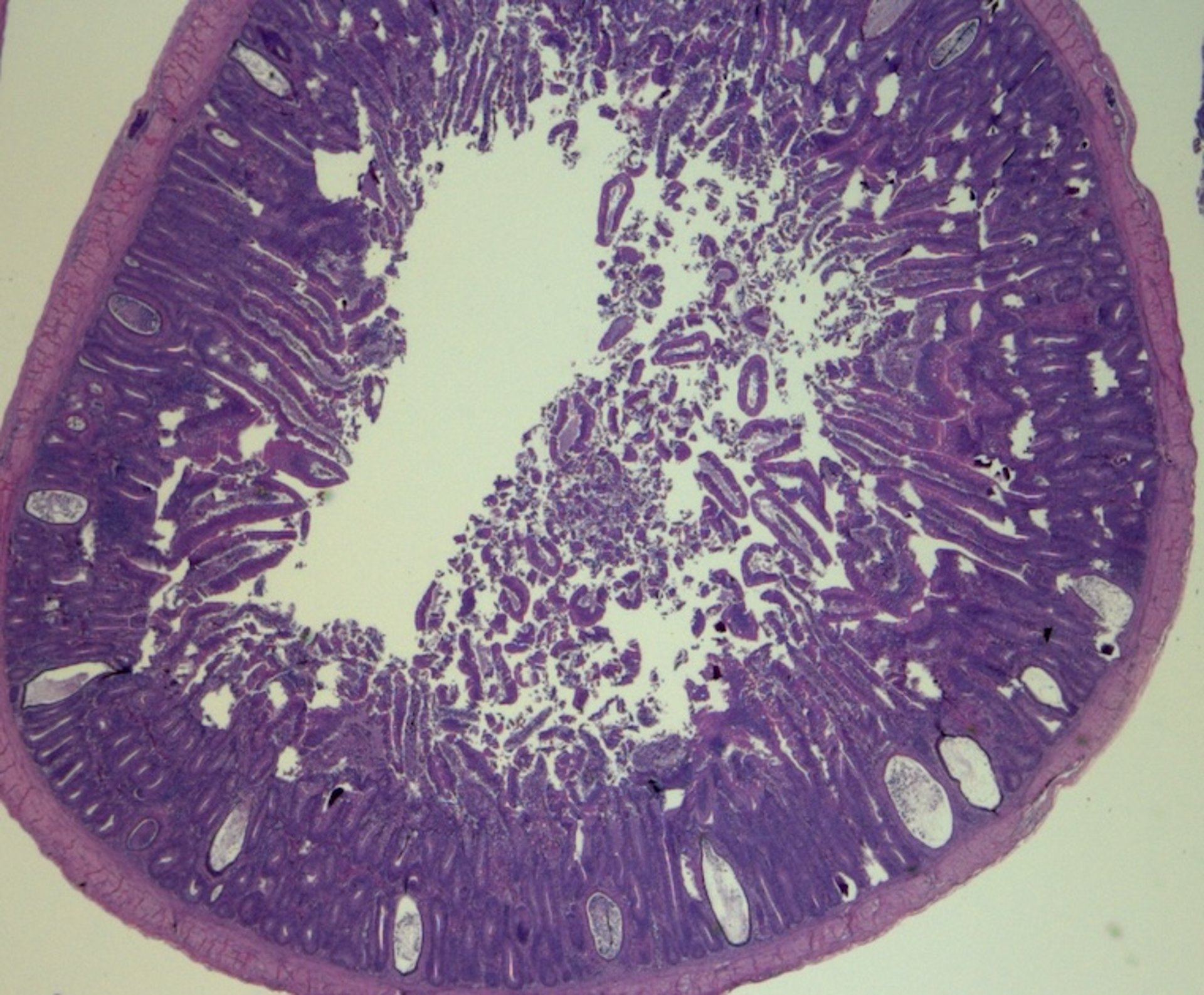 Infección por astrovirus, enteropatía quística, polluelo