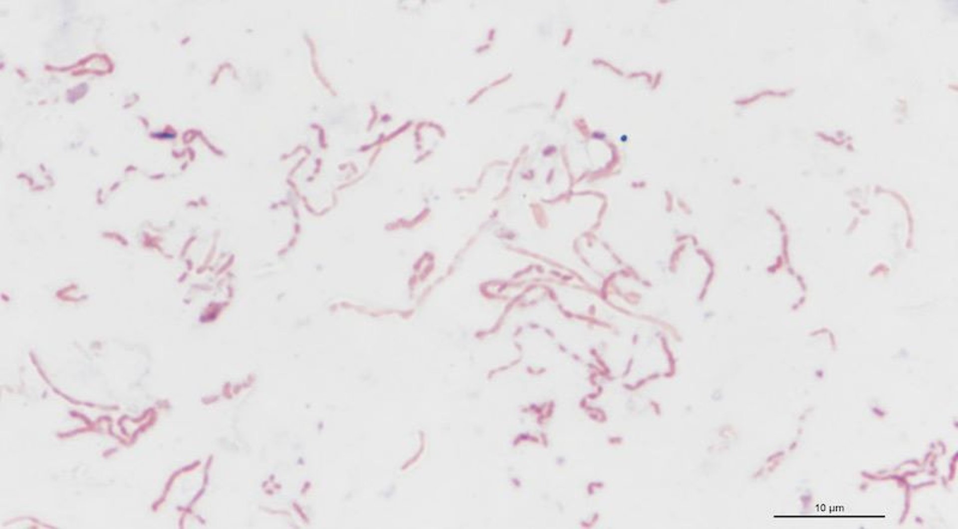 Microfotografía de <i >Avibacterium paragallinarum</i> después del cultivo de una muestra en agar sangre