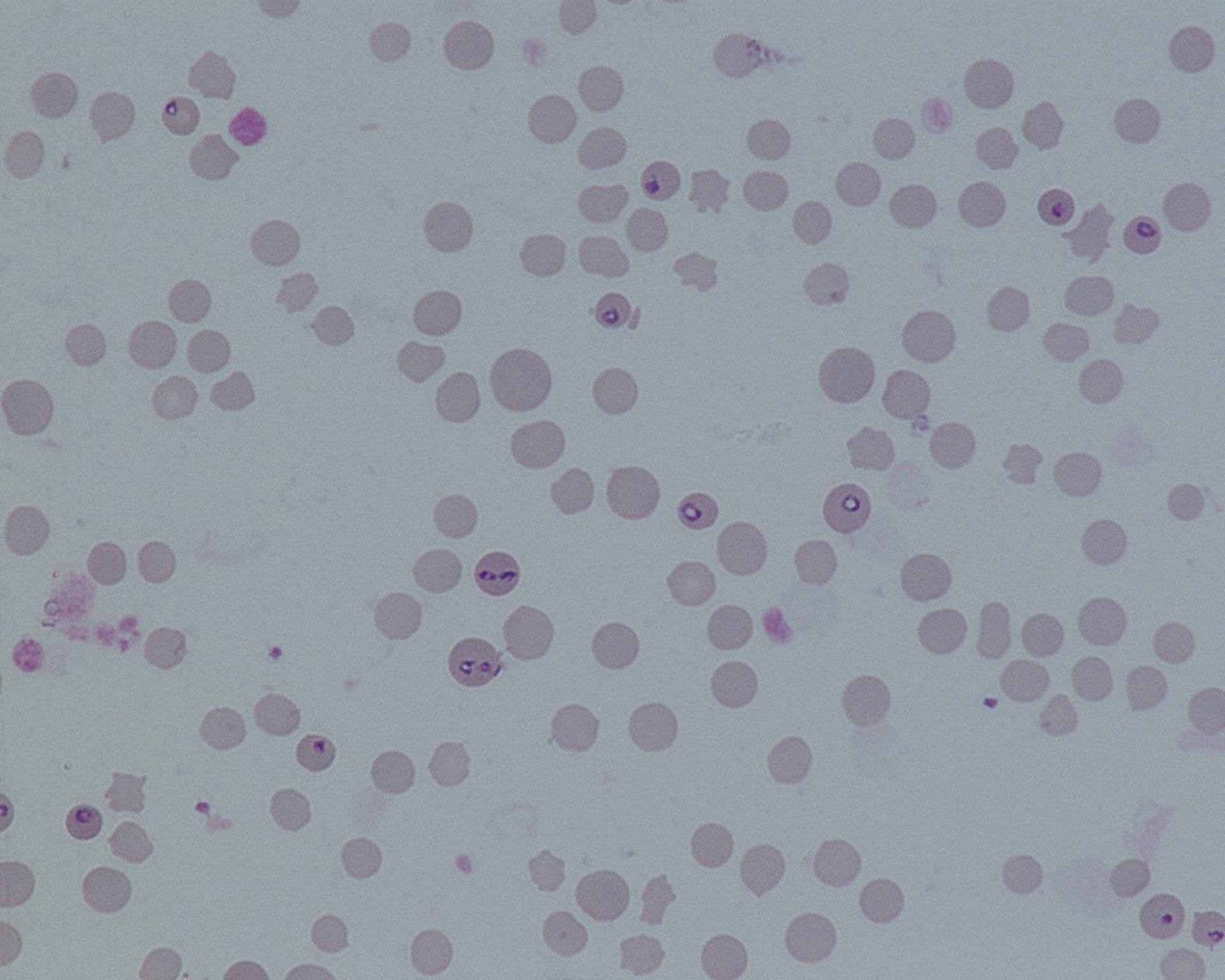 <i >Babesia bovis</i>, frotis de sangre, vaca