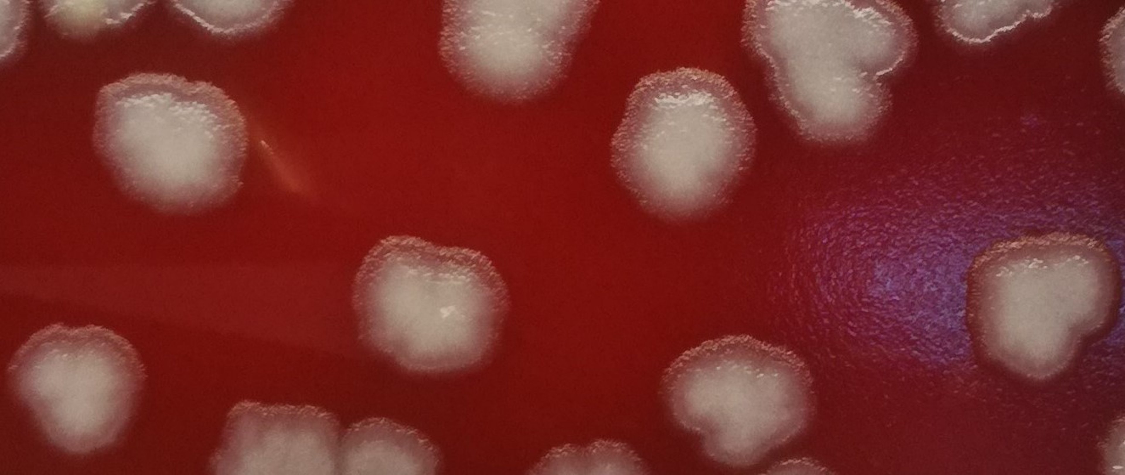 <i >Bacillus anthracis</i> colonies