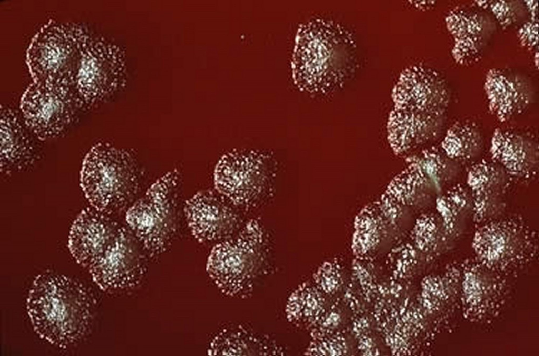 <i >Bacillus anthracis</i>, ground glass colonies