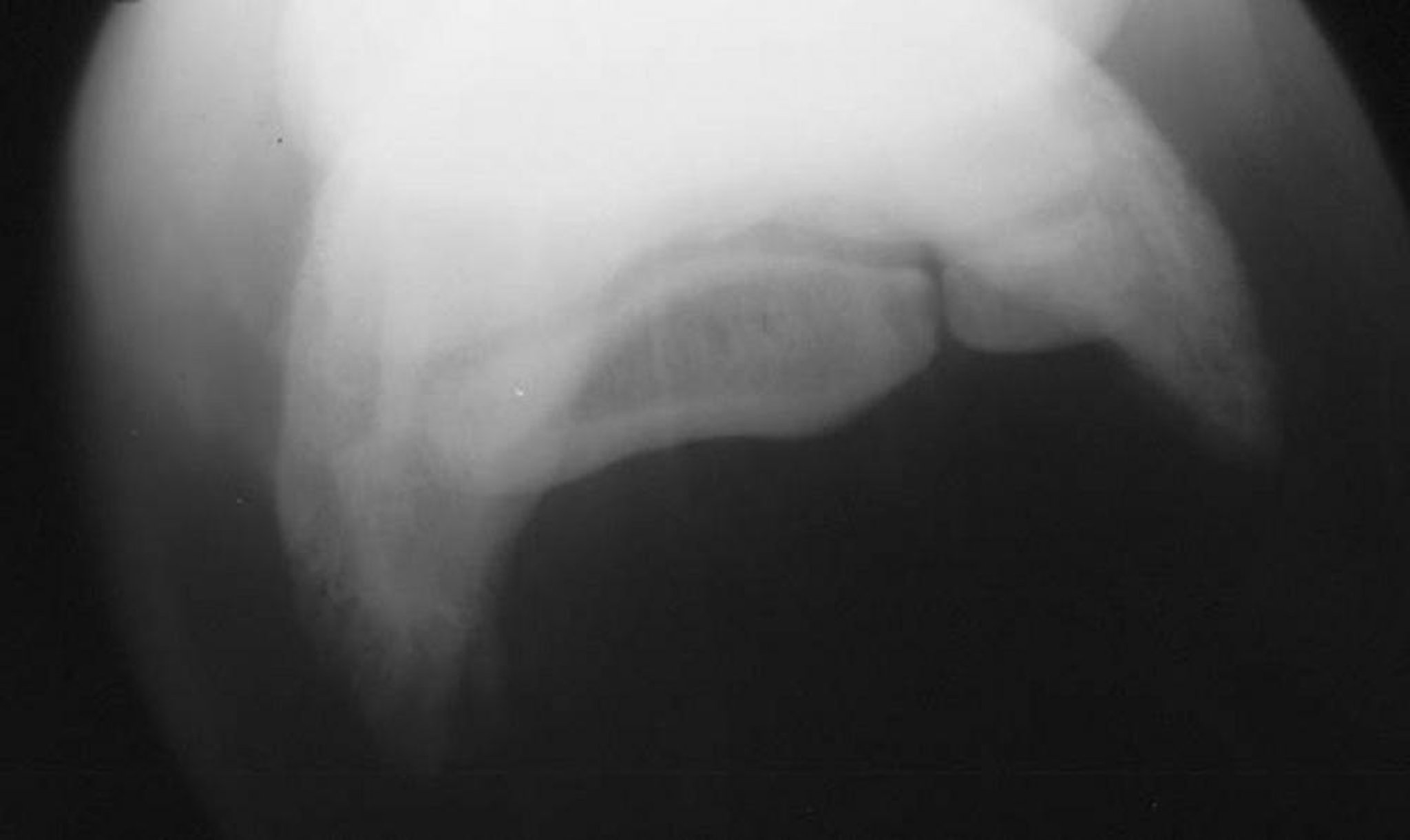 Bipartite navicular bone, radiograph, horse