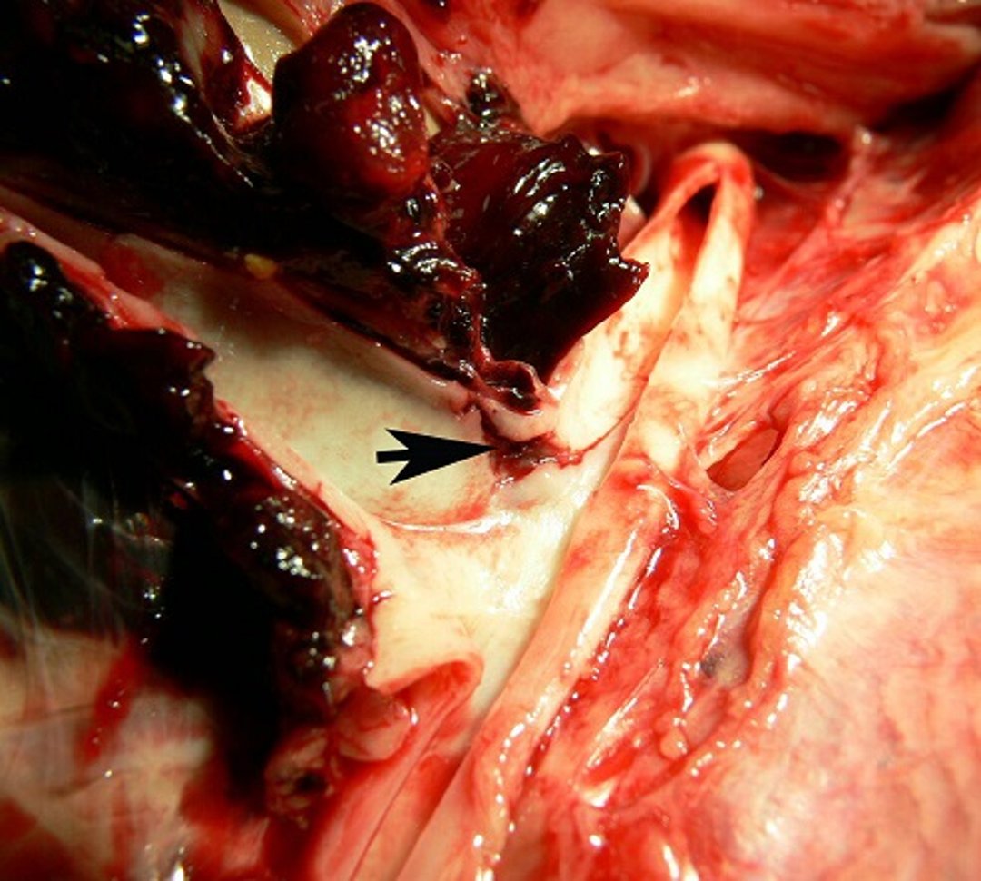 Blood clots from aortic rupture, turkey