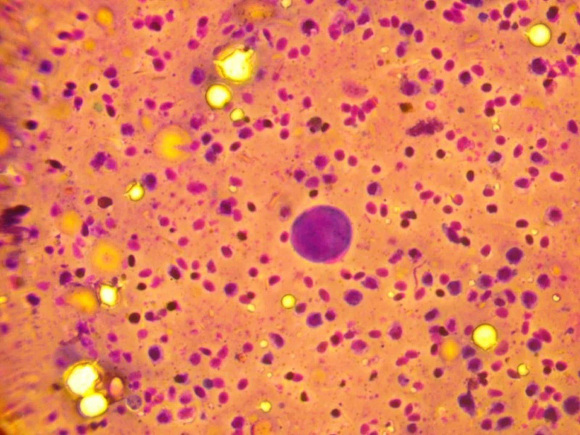 Romanowsky stain variant of spleen, ram cichlid